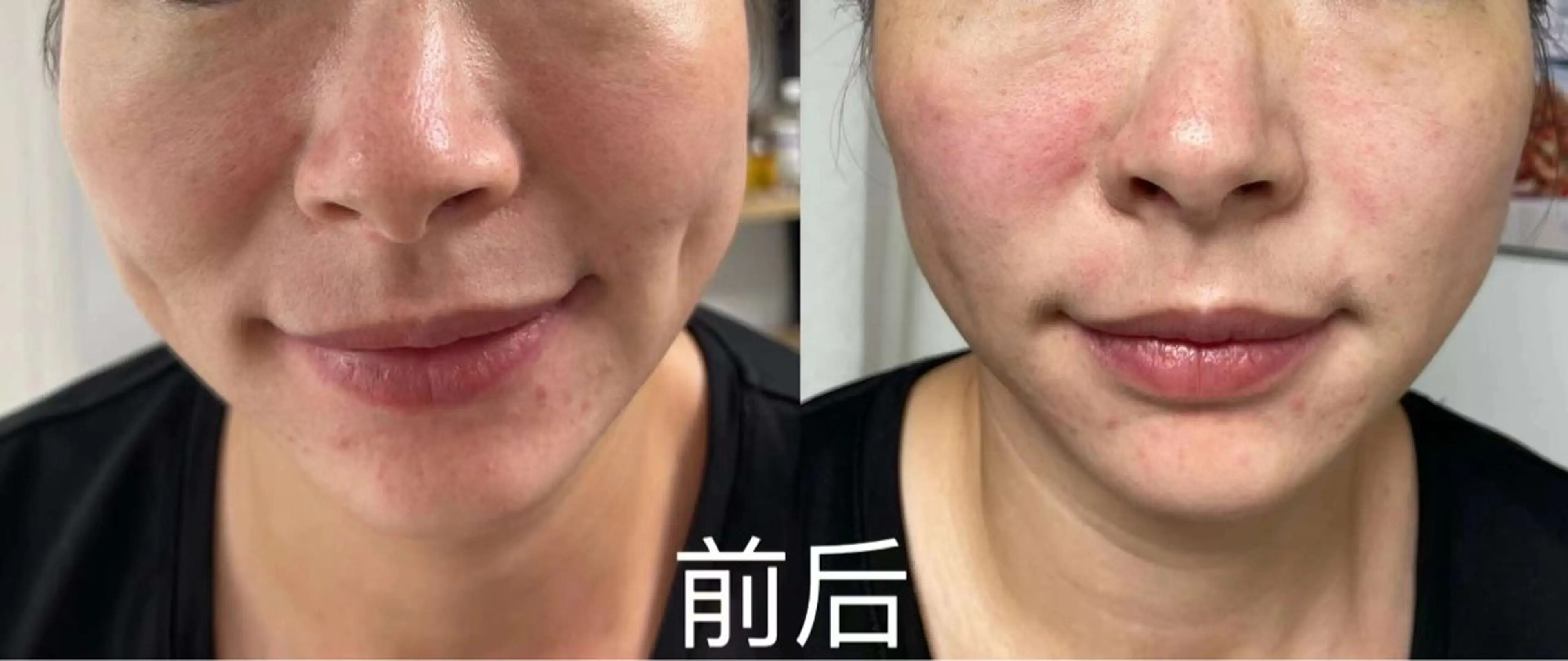マツエク・マツパ エステ aliaハイフ&水光ジェットサロン所属・aliaハーブ水光店 エステティシャン募集のエステ・リラクイメージ