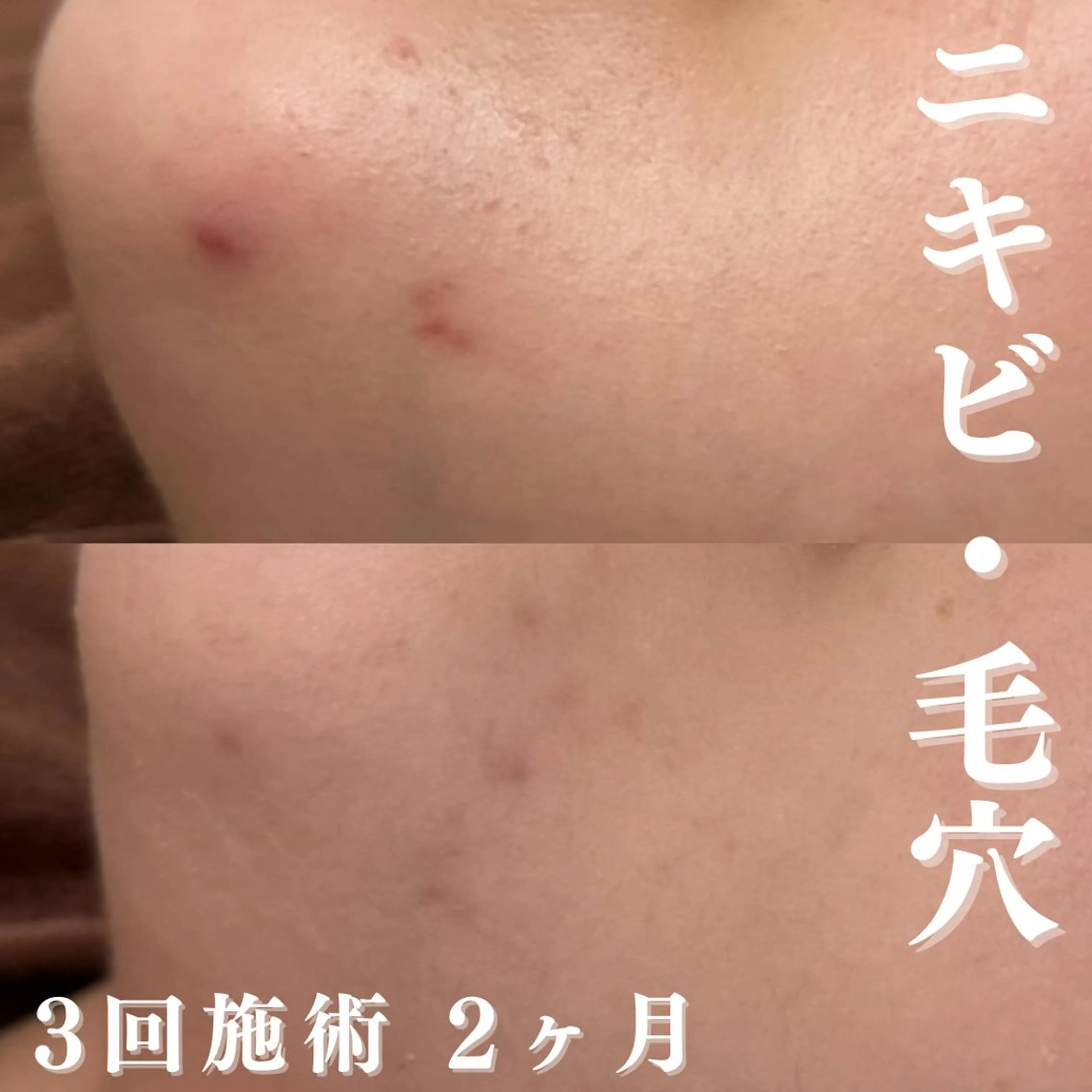 憧れの韓流すっぴん肌 🤎肌管理専門エステのエステ・リラクイメージ