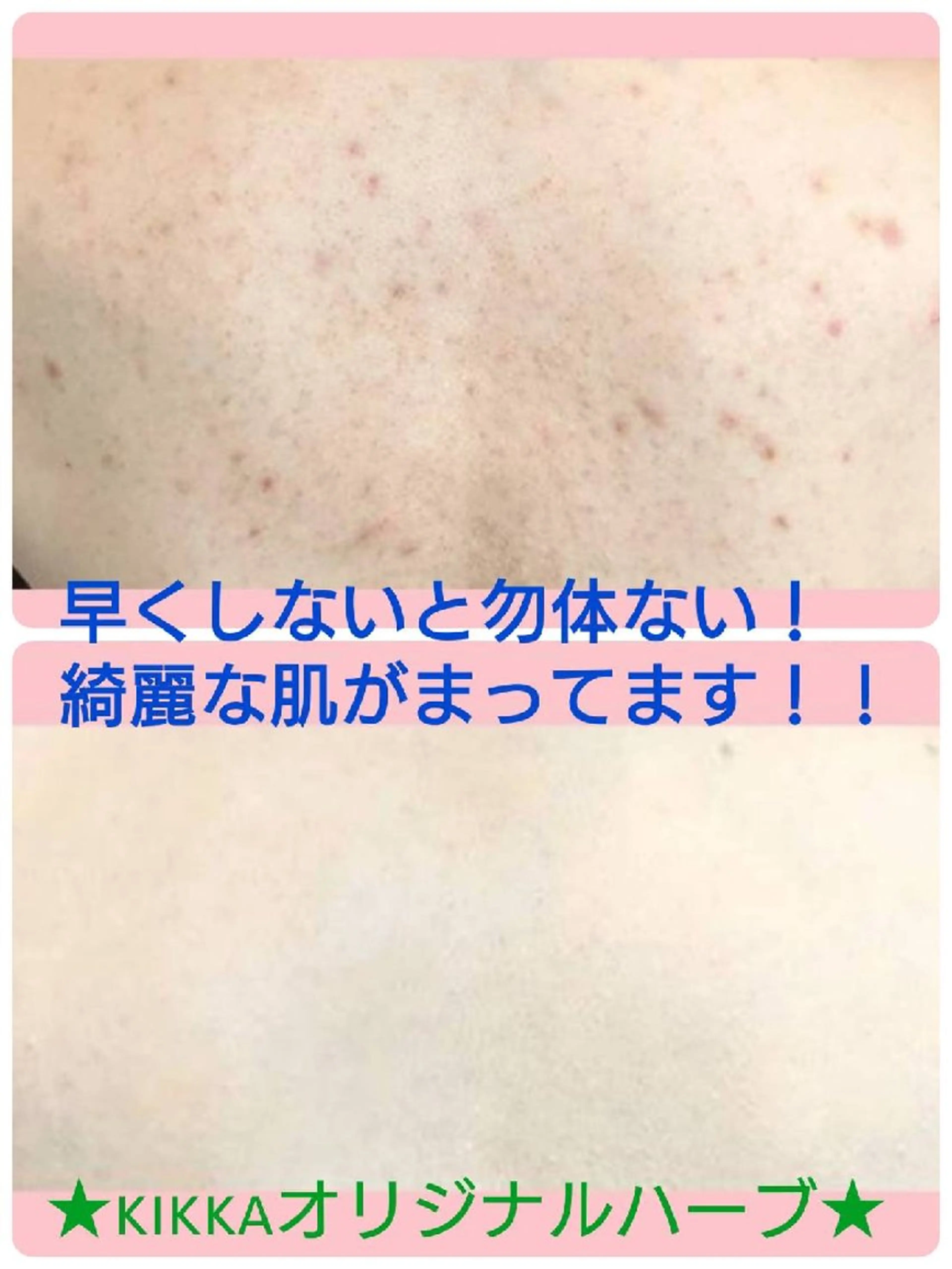 エステ ハーブピーリング 専門店Kikkaのエステ・リラクイメージ