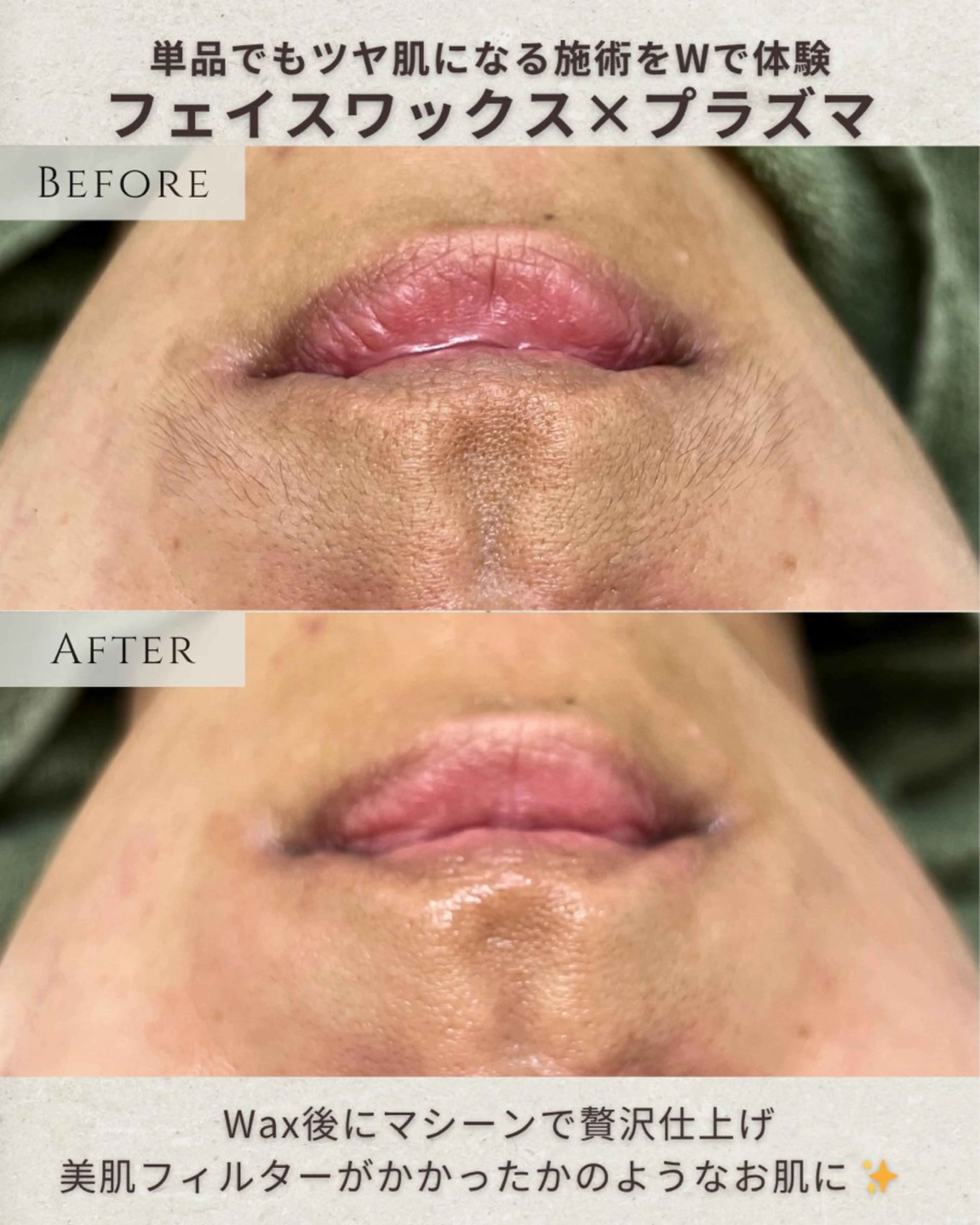 エステ シミ毛穴ケア EsteAのエステ・リラクイメージ