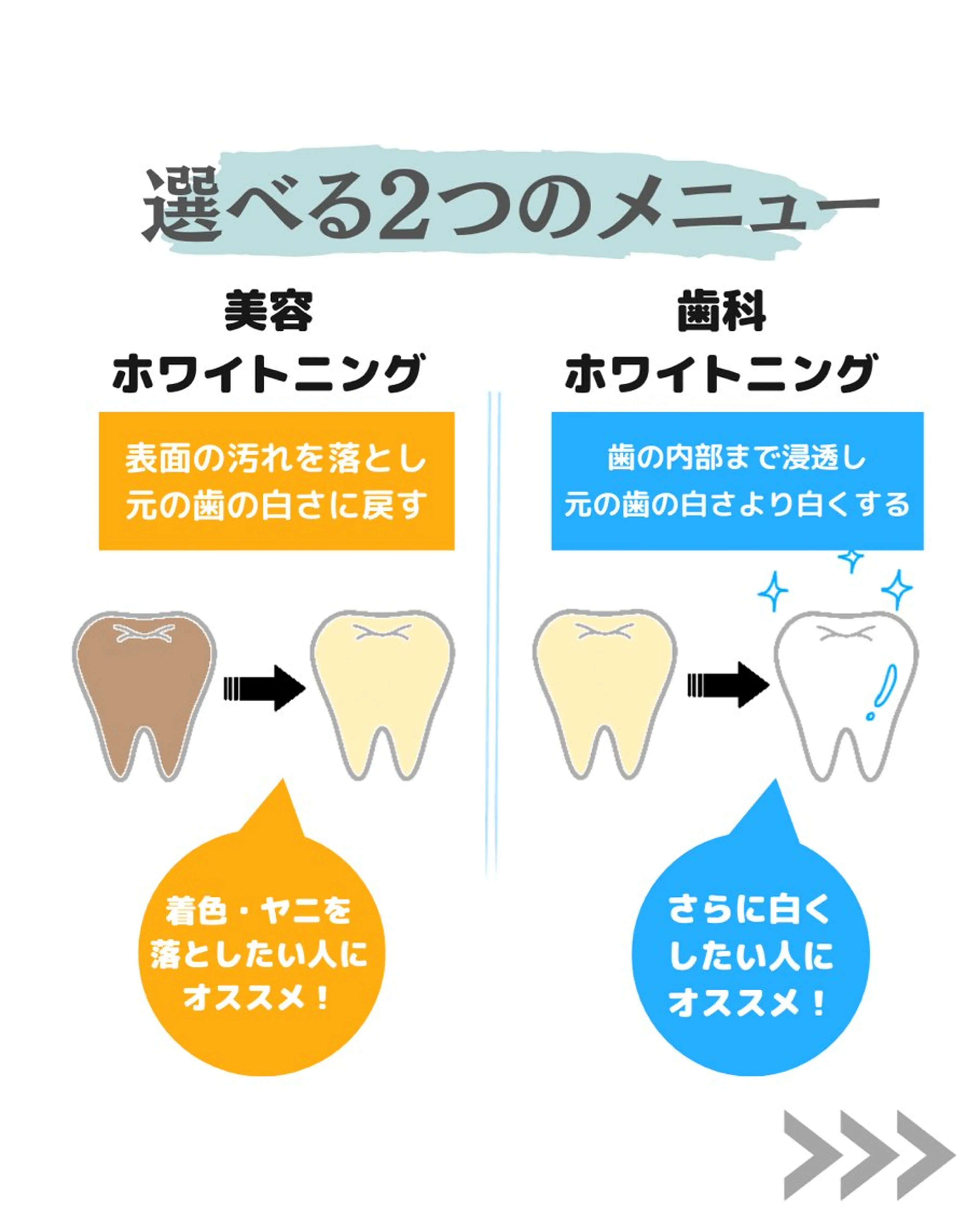 歯のセルフホワイトニング専門店GLOW(グロウ)所属・東区香椎歯のセルフホ ワイトニングGLOWのその他イメージ
