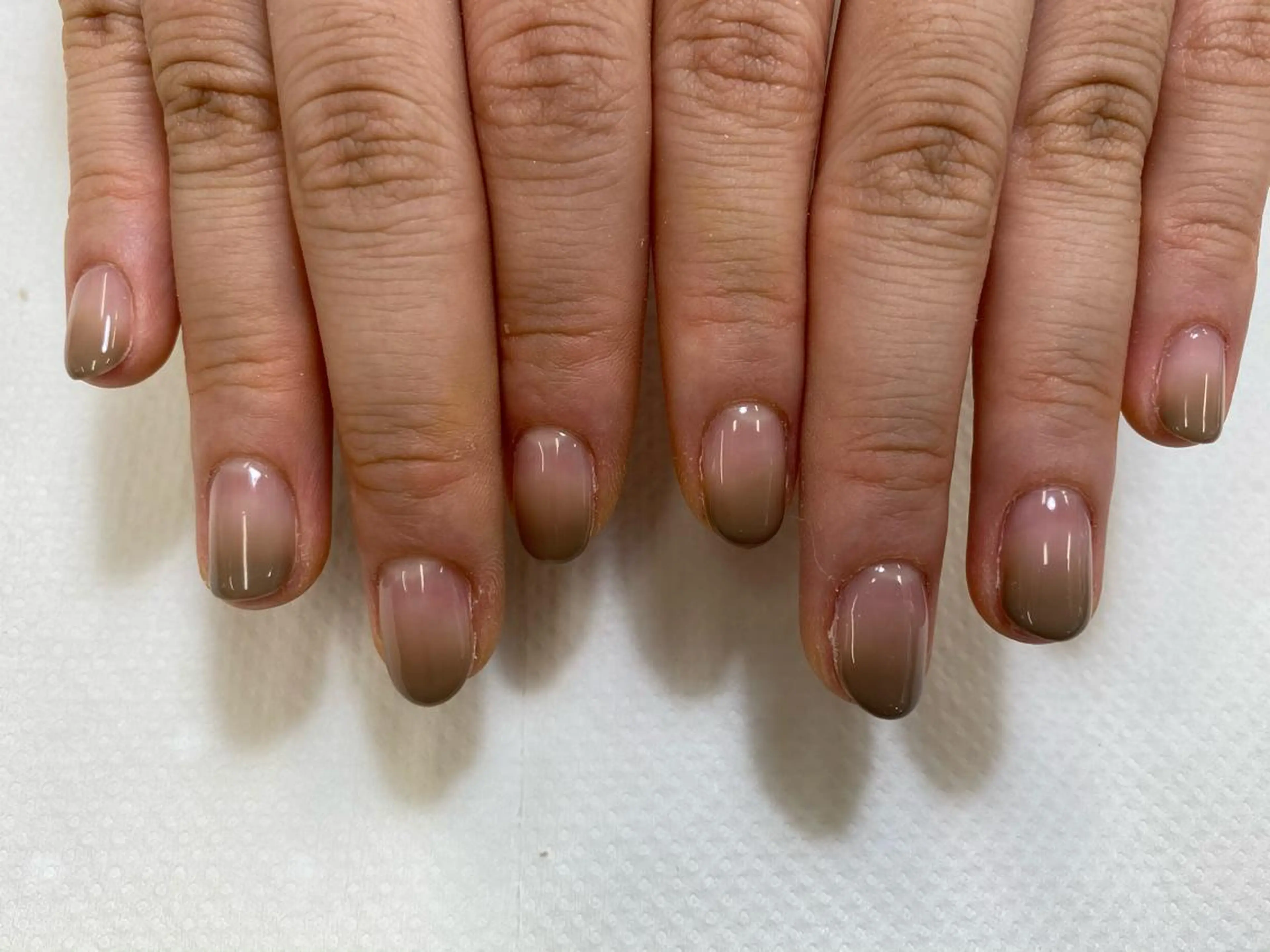 ネイル 巻き爪補正 Umber　Miyaのネイルデザイン