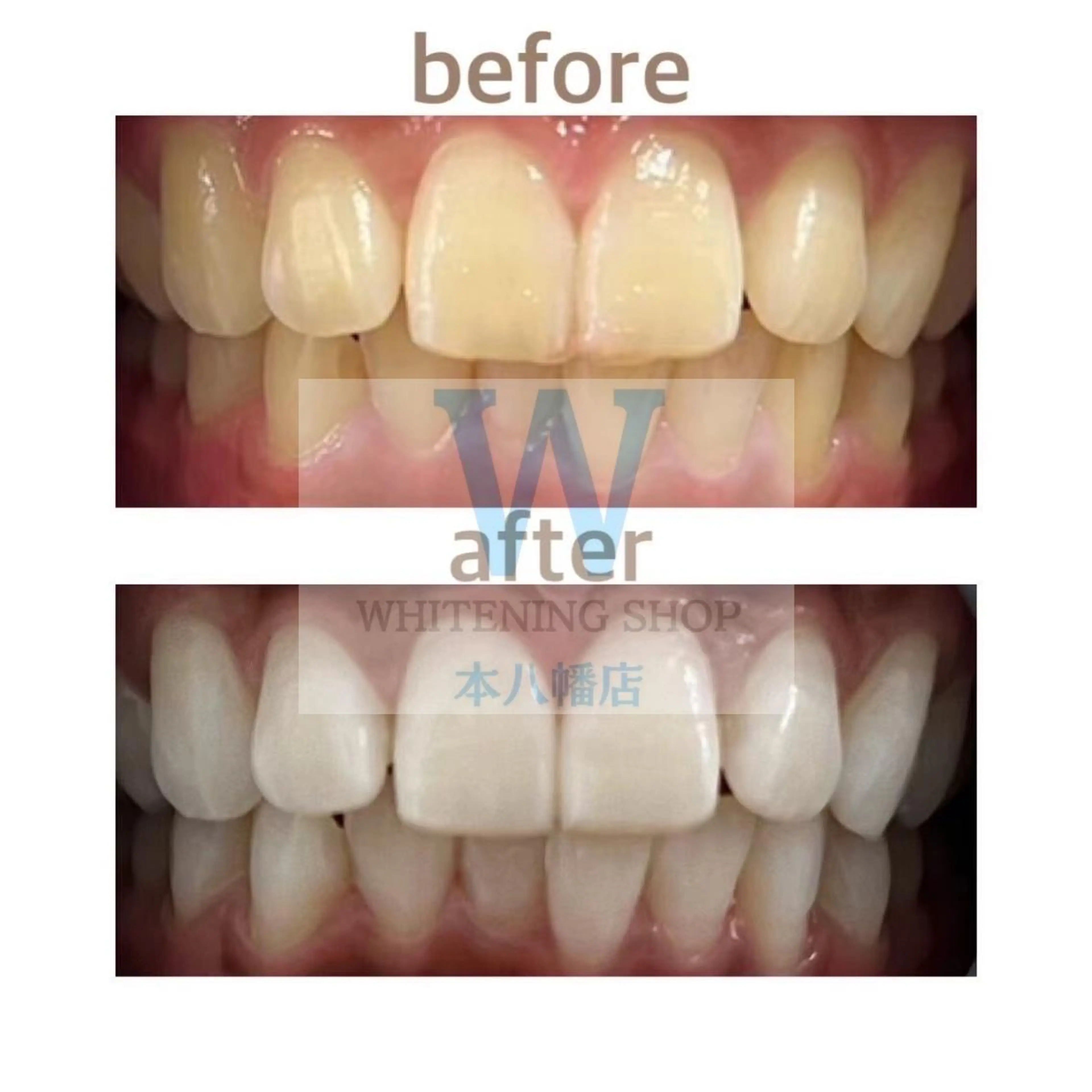 ホワイトニング ショップ本八幡店のエステ・リラクイメージ