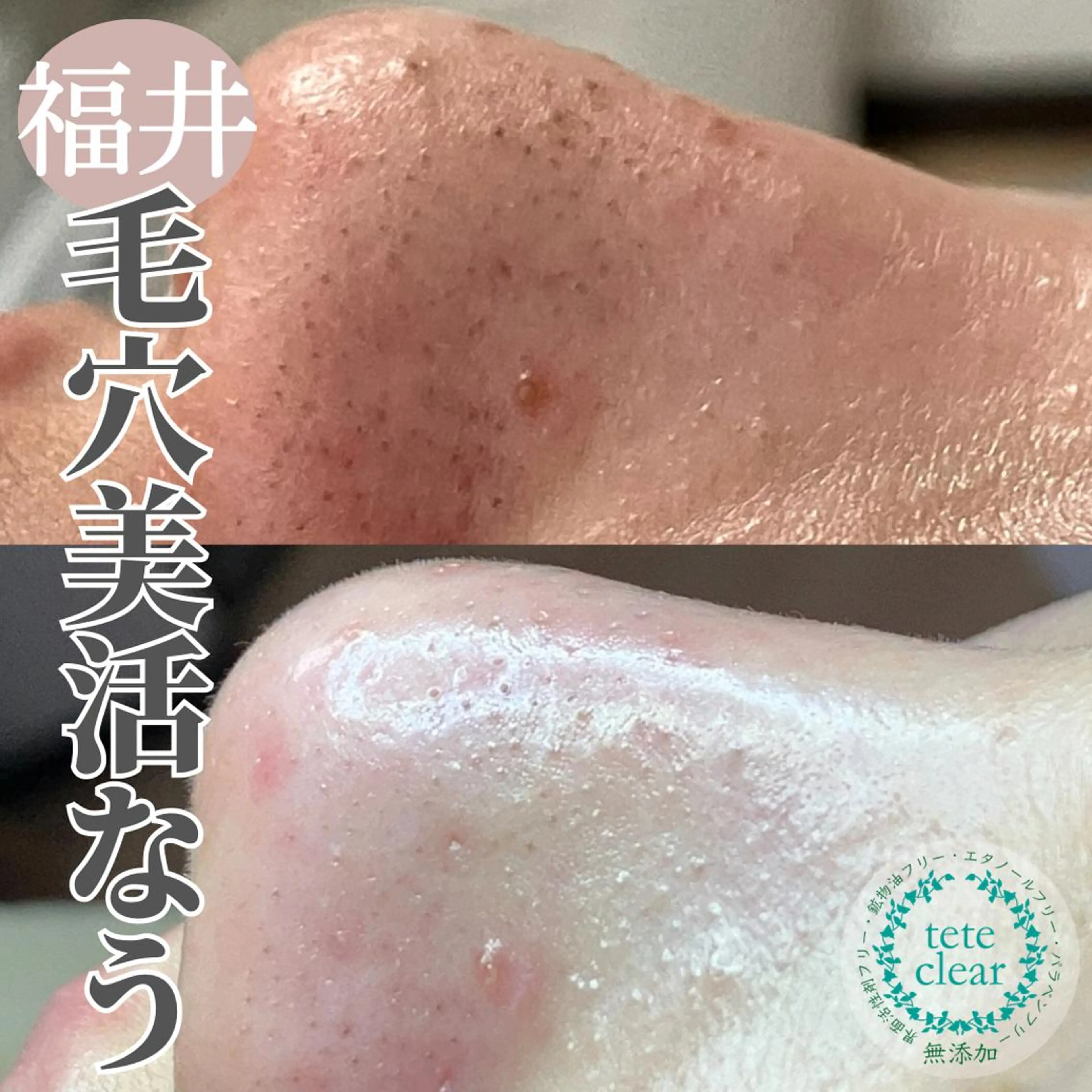 毛穴ケア専門サロン Yourmeユアミーのエステ・リラクイメージ