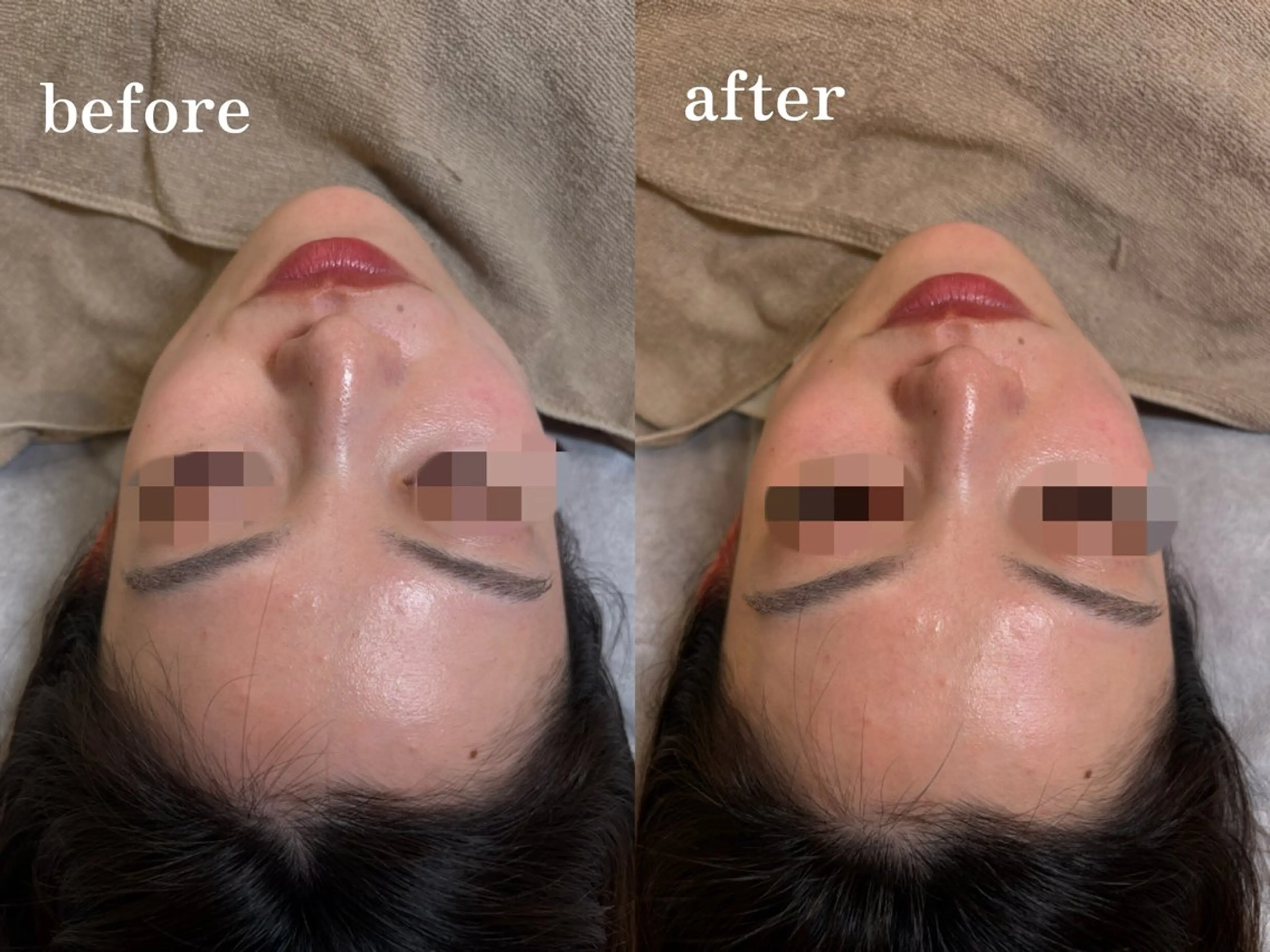 【時短コース】食いしばりほぐし&フェイスライン整えプラン🪴の写真