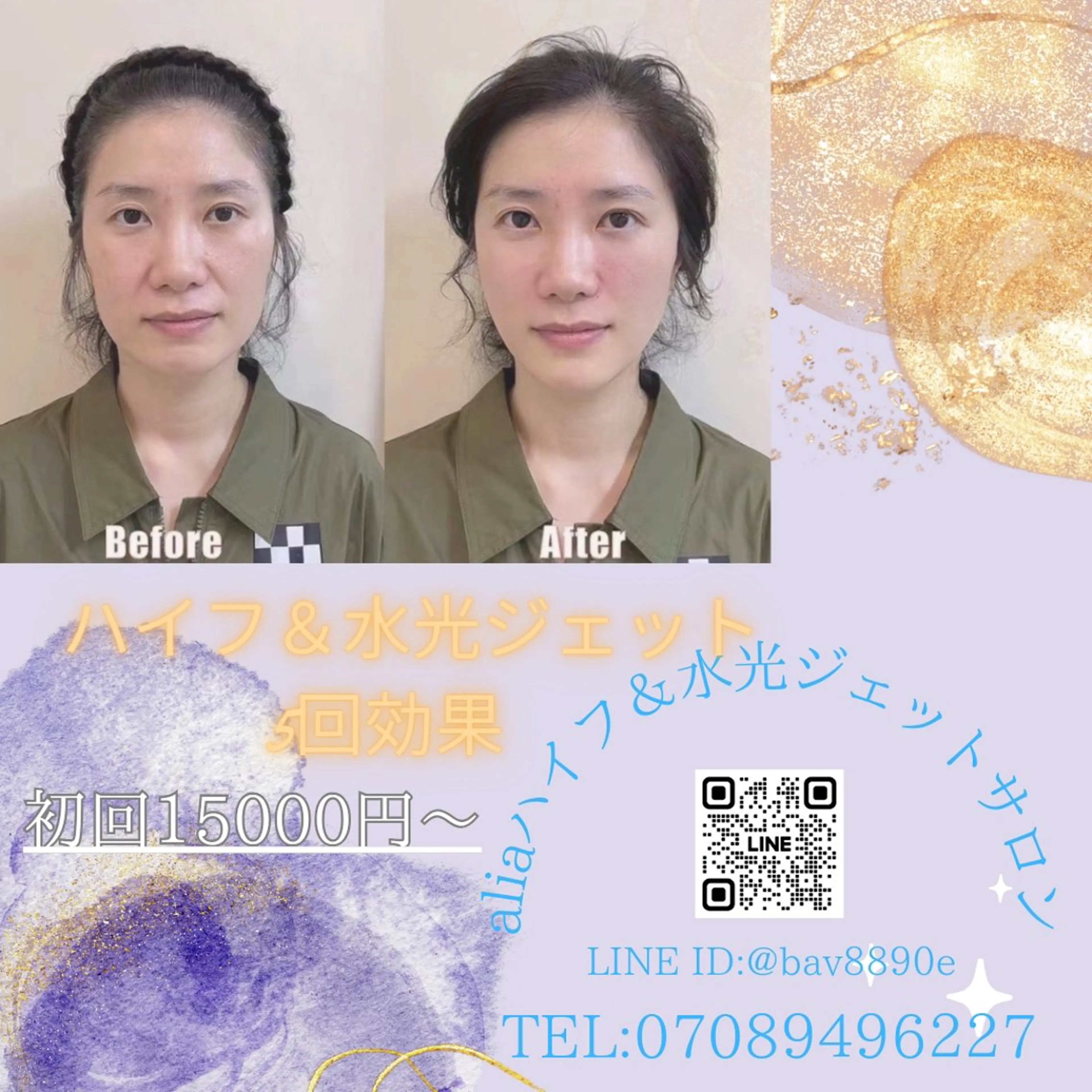 マツエク・マツパ 韓国風マツエク エステ aliaハイフ&水光ジェットサロン所属・aliaハーブ水光店 エステティシャン募集のエステ・リラクイメージ