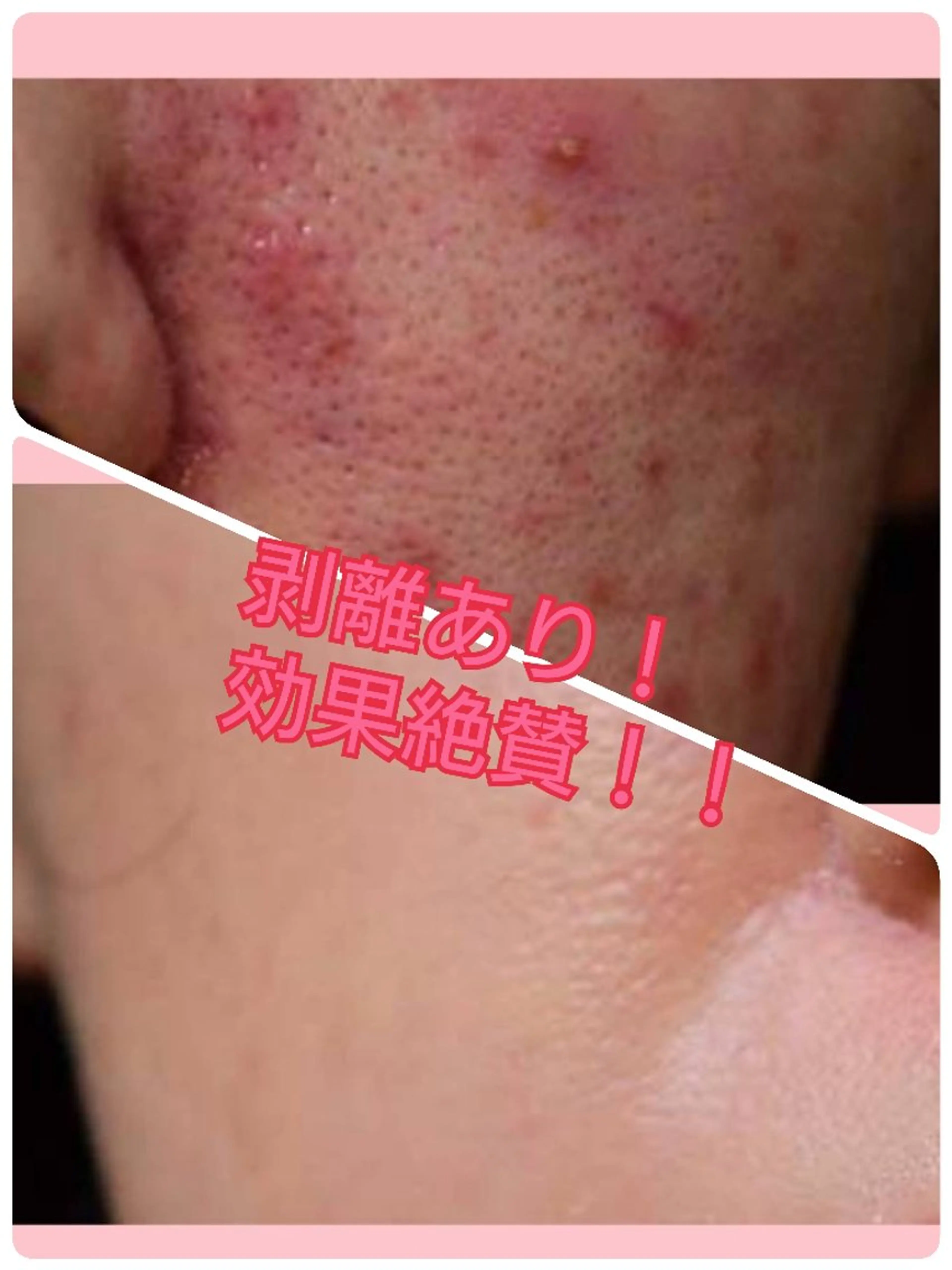 エステ ハーブピーリング 専門店Kikkaのエステ・リラクイメージ