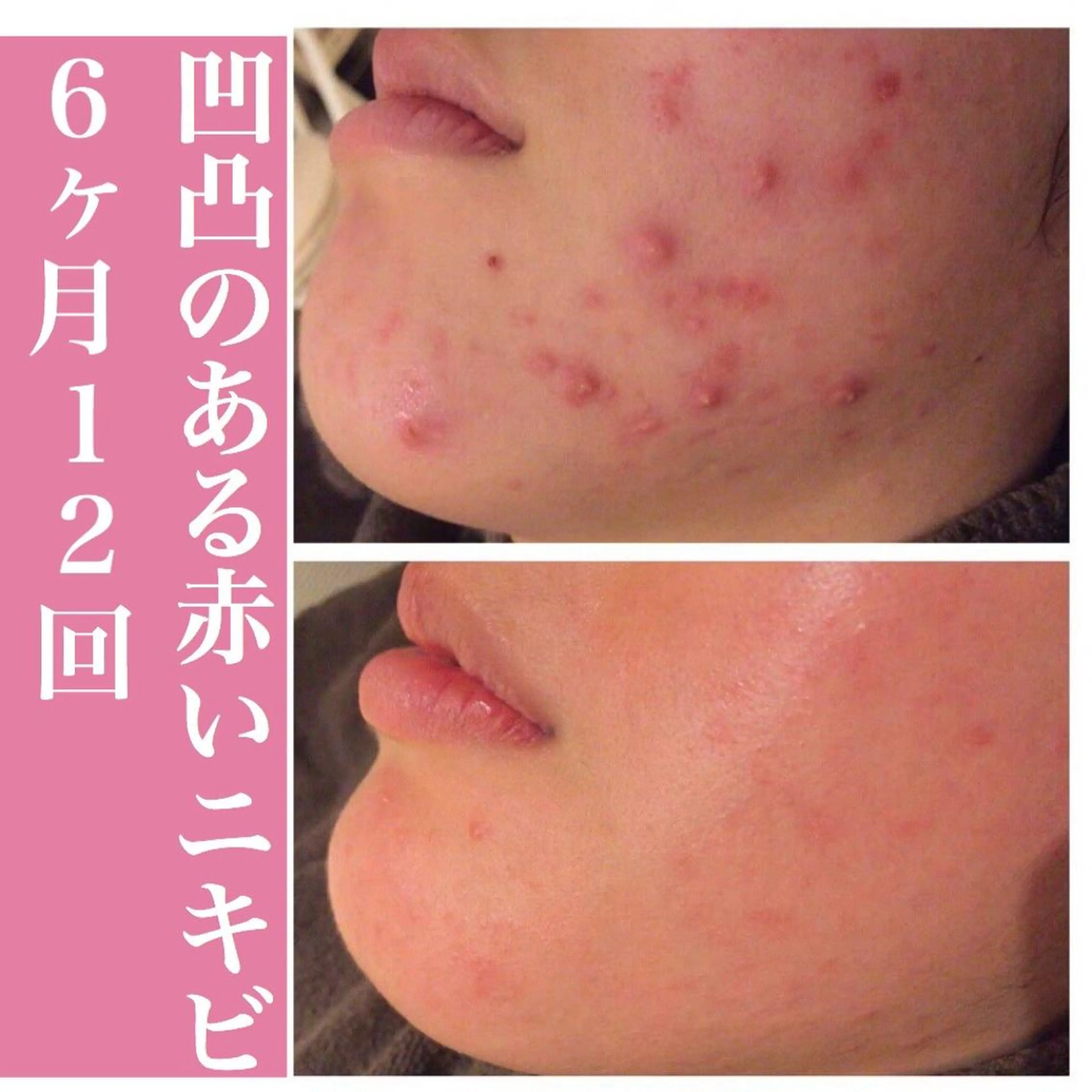 ミディアム カラー パーマ ヘアアレンジ メンズ キッズ ネイル マツエク・マツパ アイブロウ エステ リラク アクール　齋藤 ♡肌トラブル卒業のエステ・リラクイメージ