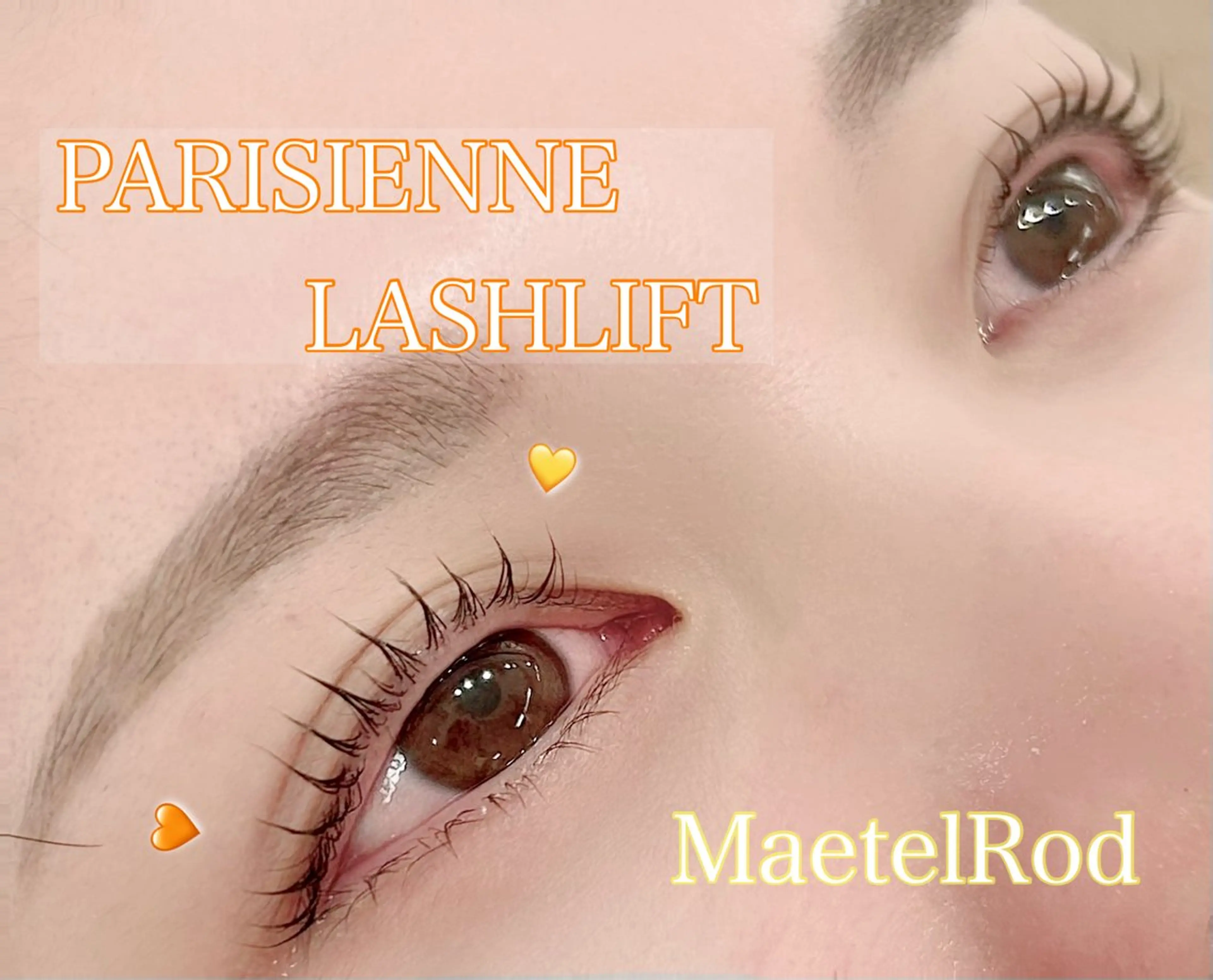 人気ナンバーワン💛🧡メーテルラッシュの写真