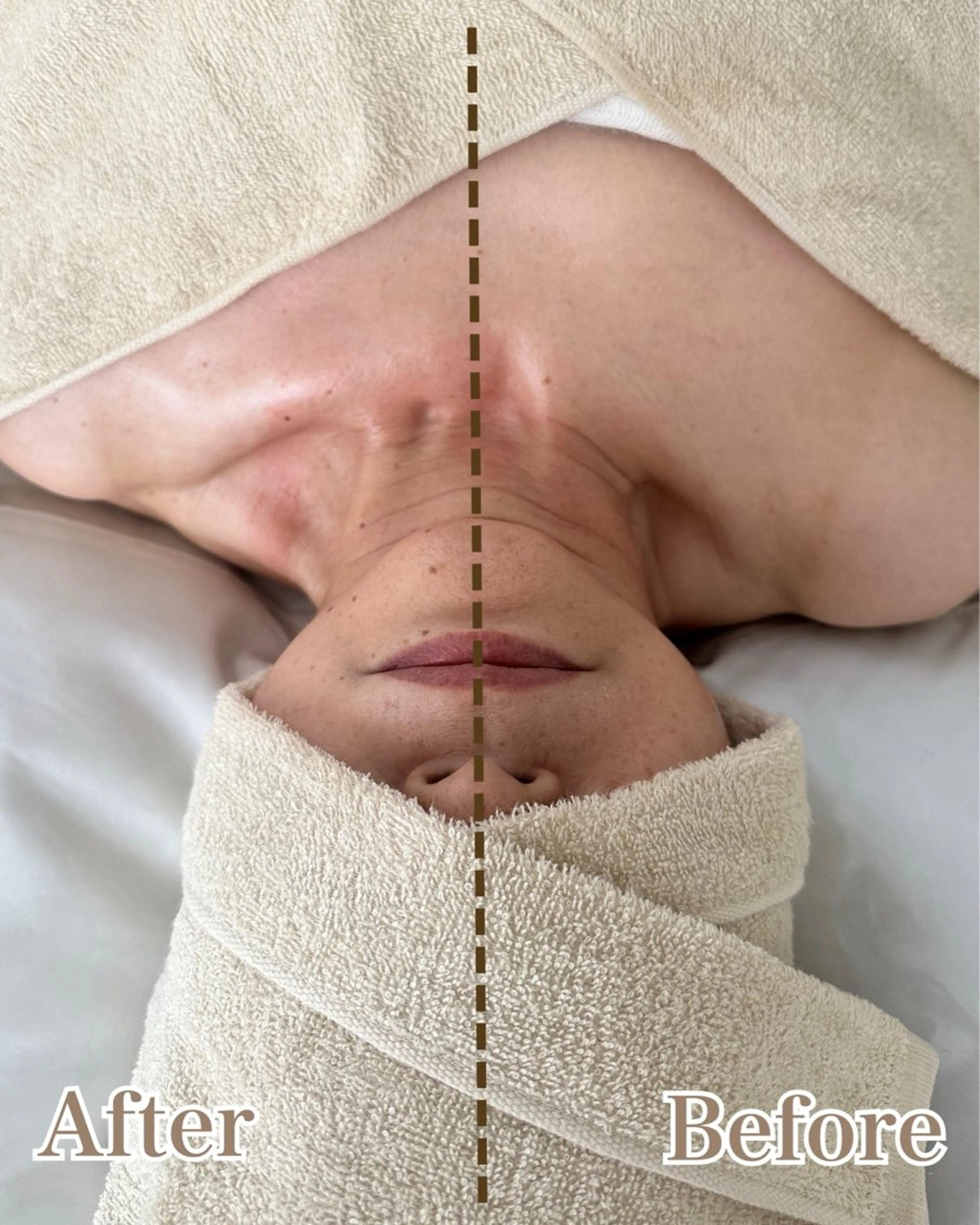 たるみ、むくみが気になる方へ★小顔トリートメント60分の写真