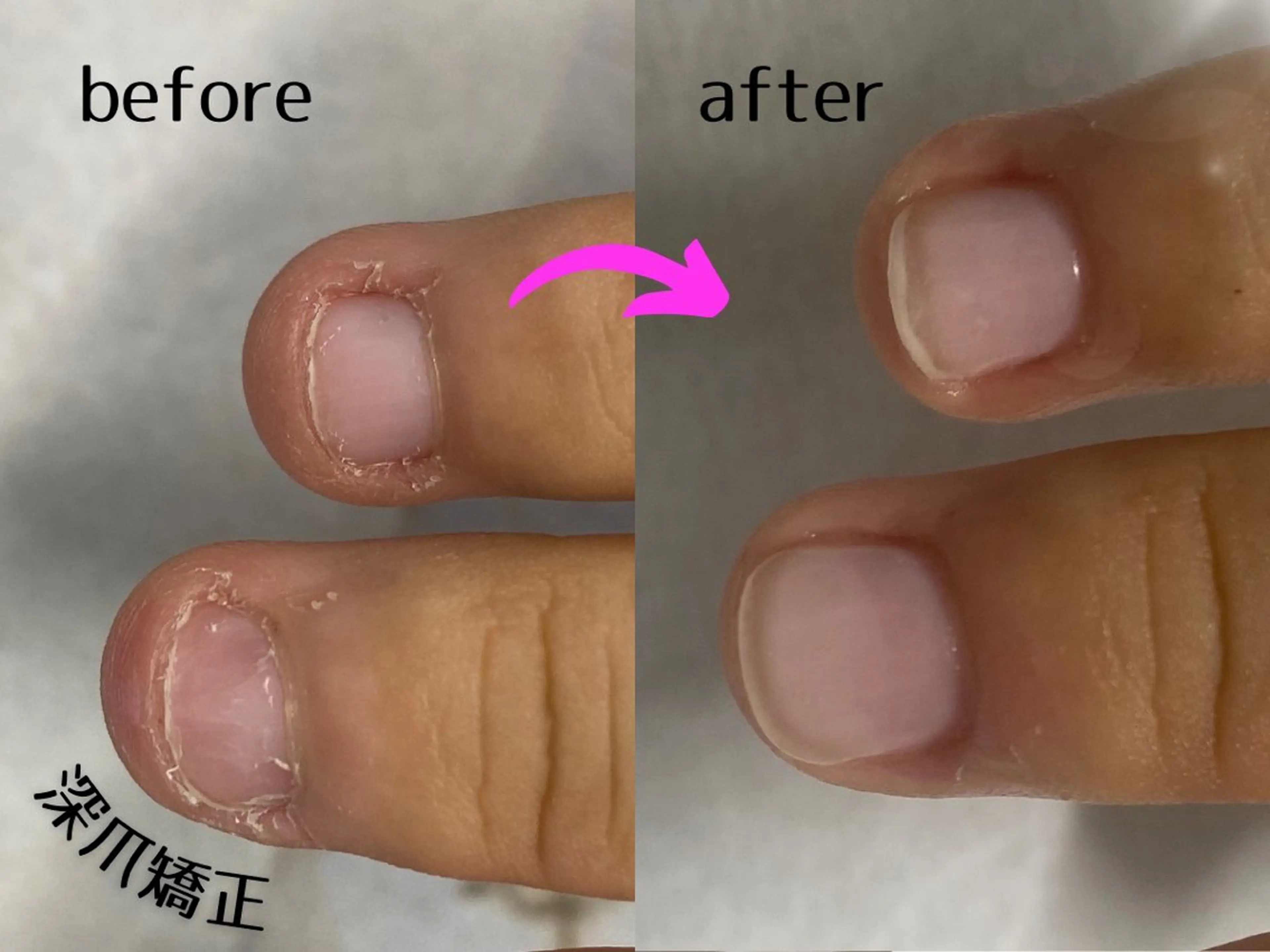 ネイル No&33所属・No&33 nail salonのエステ・リラクイメージ