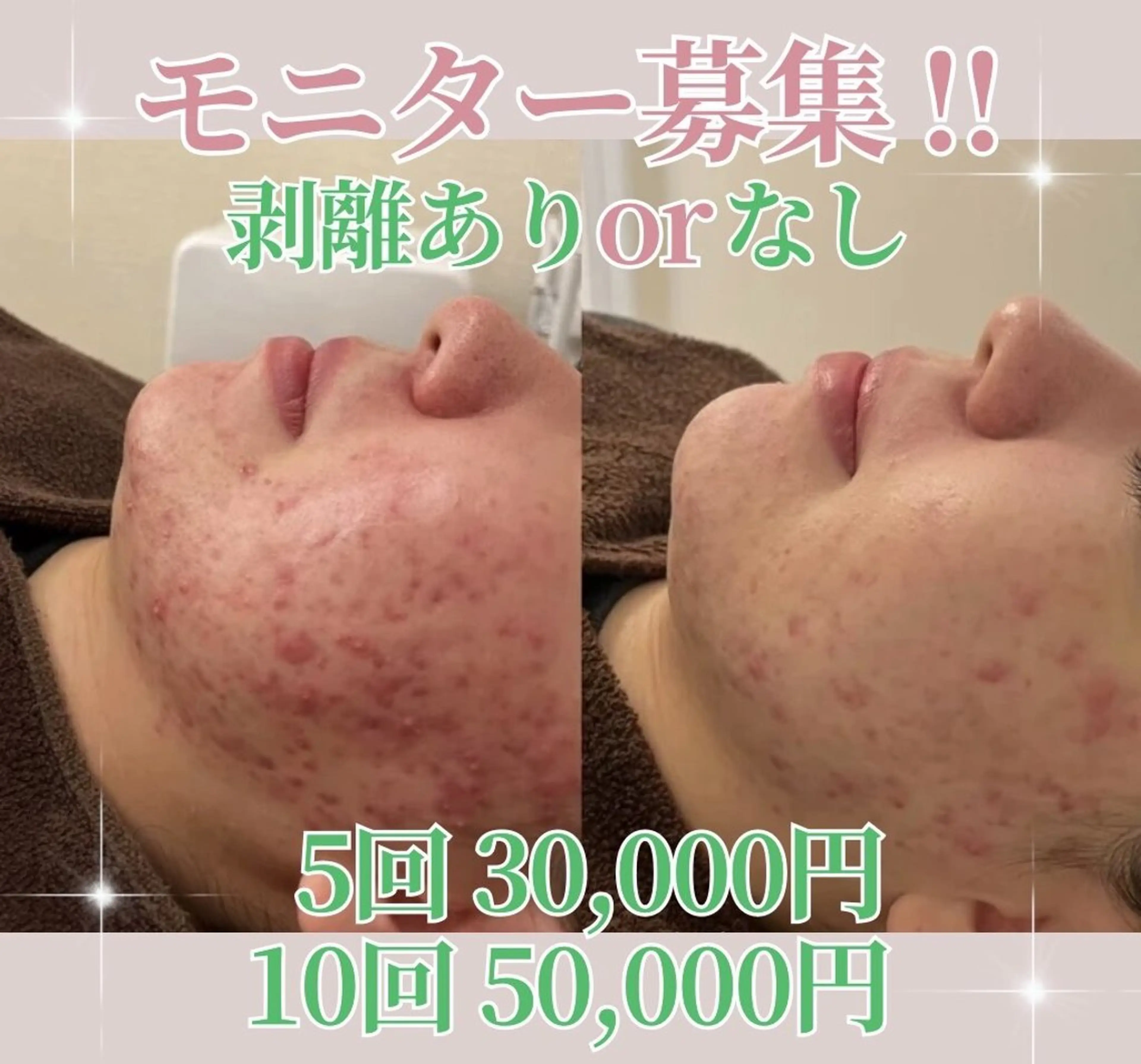 エステ 美肌ケアサロンiru博多祇園店所属・美肌ケアサロンiru 博多祇園店のエステ・リラクイメージ