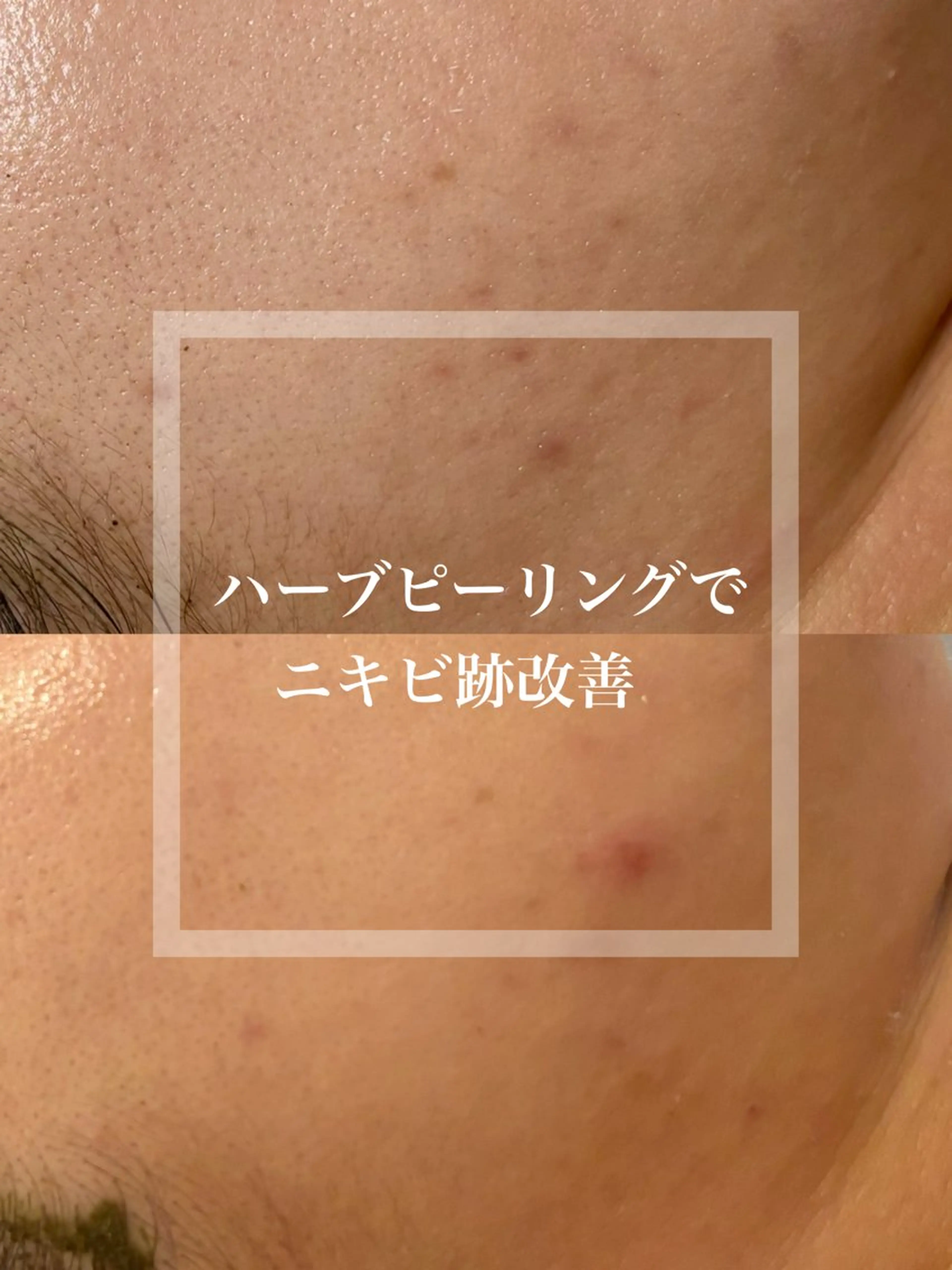 WHITE AQUA 北千住店のエステ・リラクイメージ