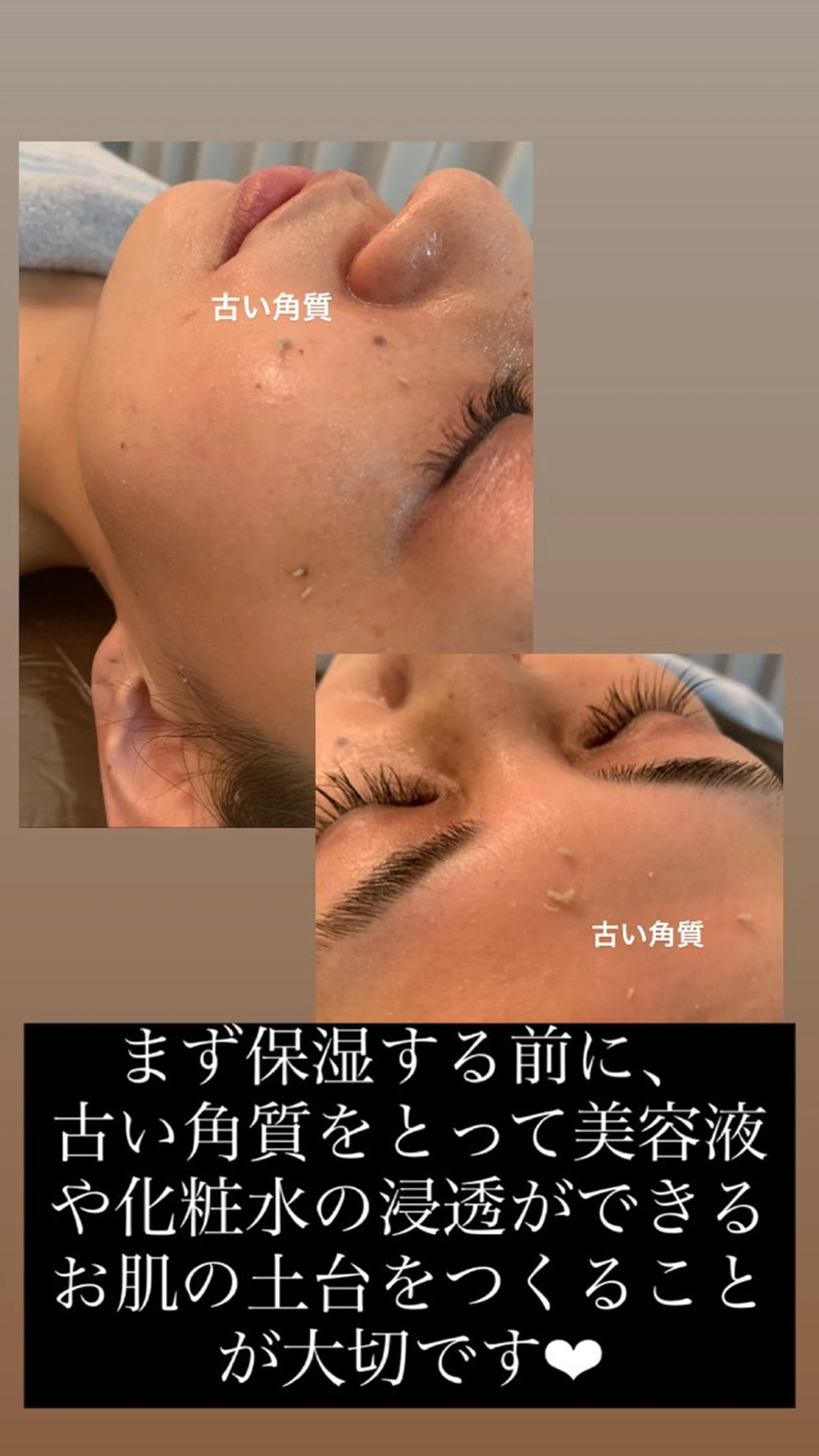【天神】毛穴・インデ ィバ・ボディケアのエステ・リラクイメージ