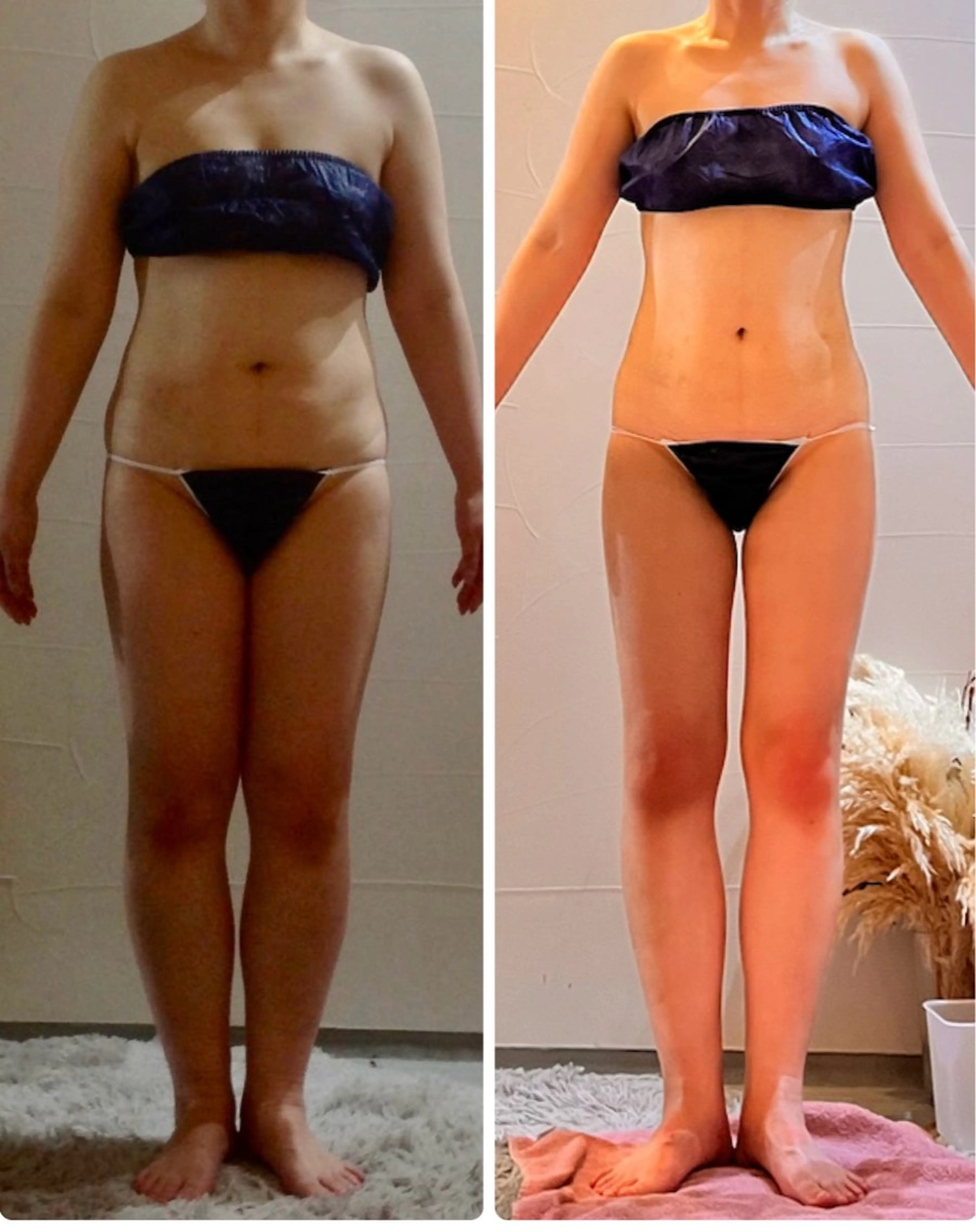 エステ 切らない脂肪吸引🔥 Neroliまりこのエステ・リラクイメージ