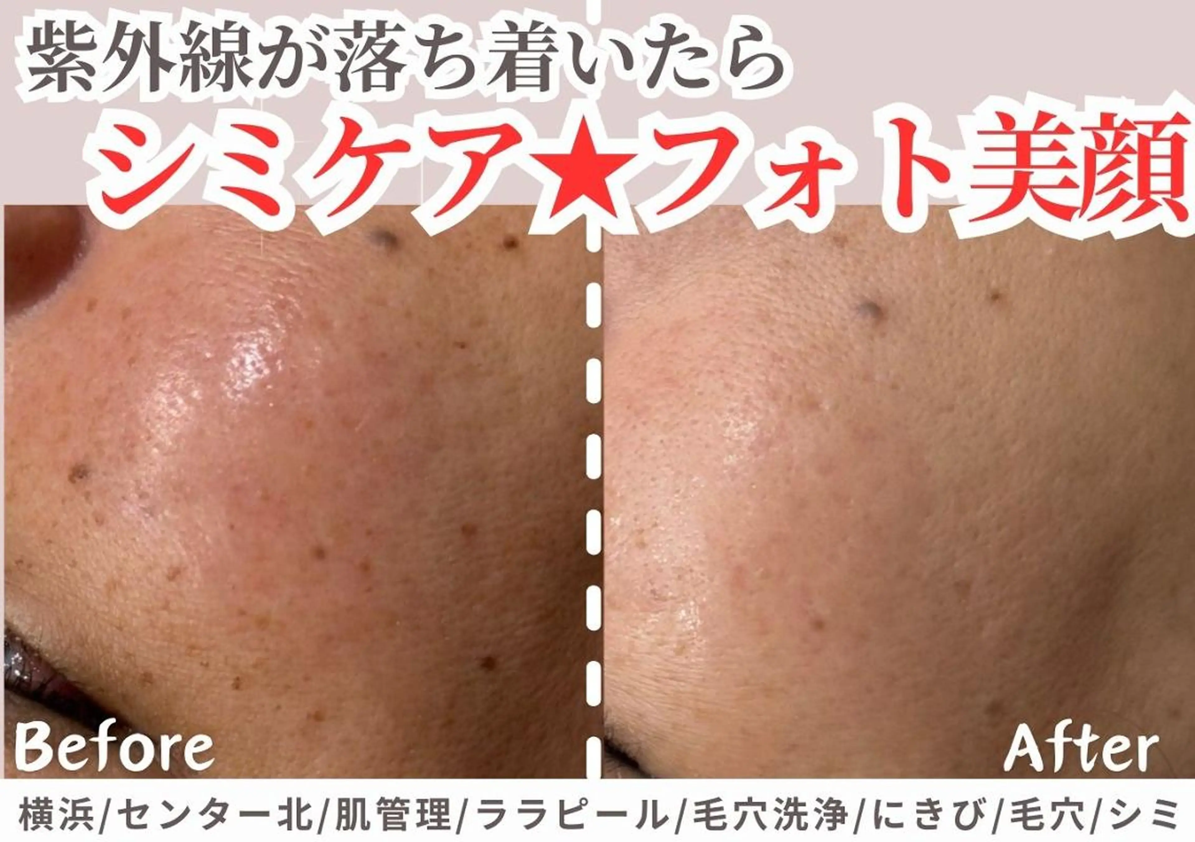 エステ sii センター北 AIのエステ・リラクイメージ