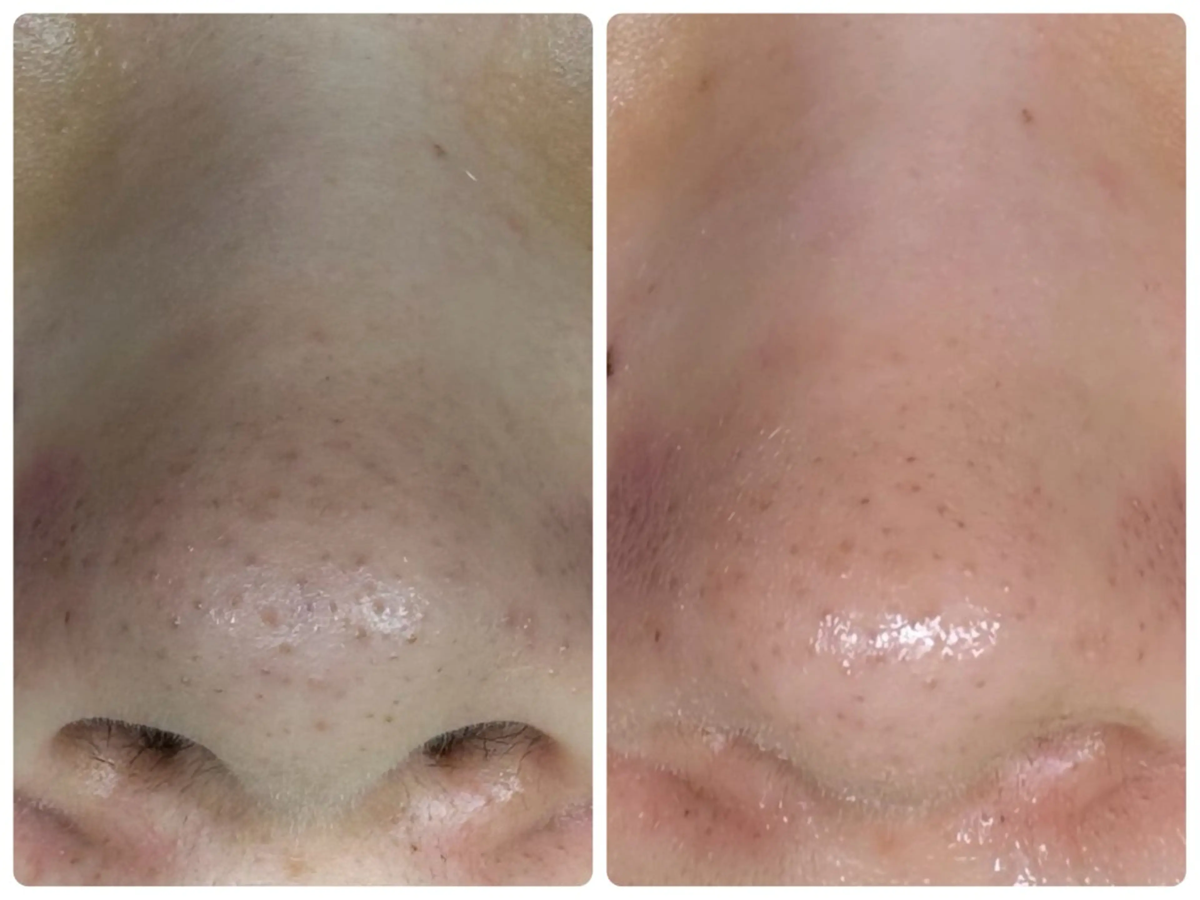 エステ 保田 千尋のエステ・リラクイメージ