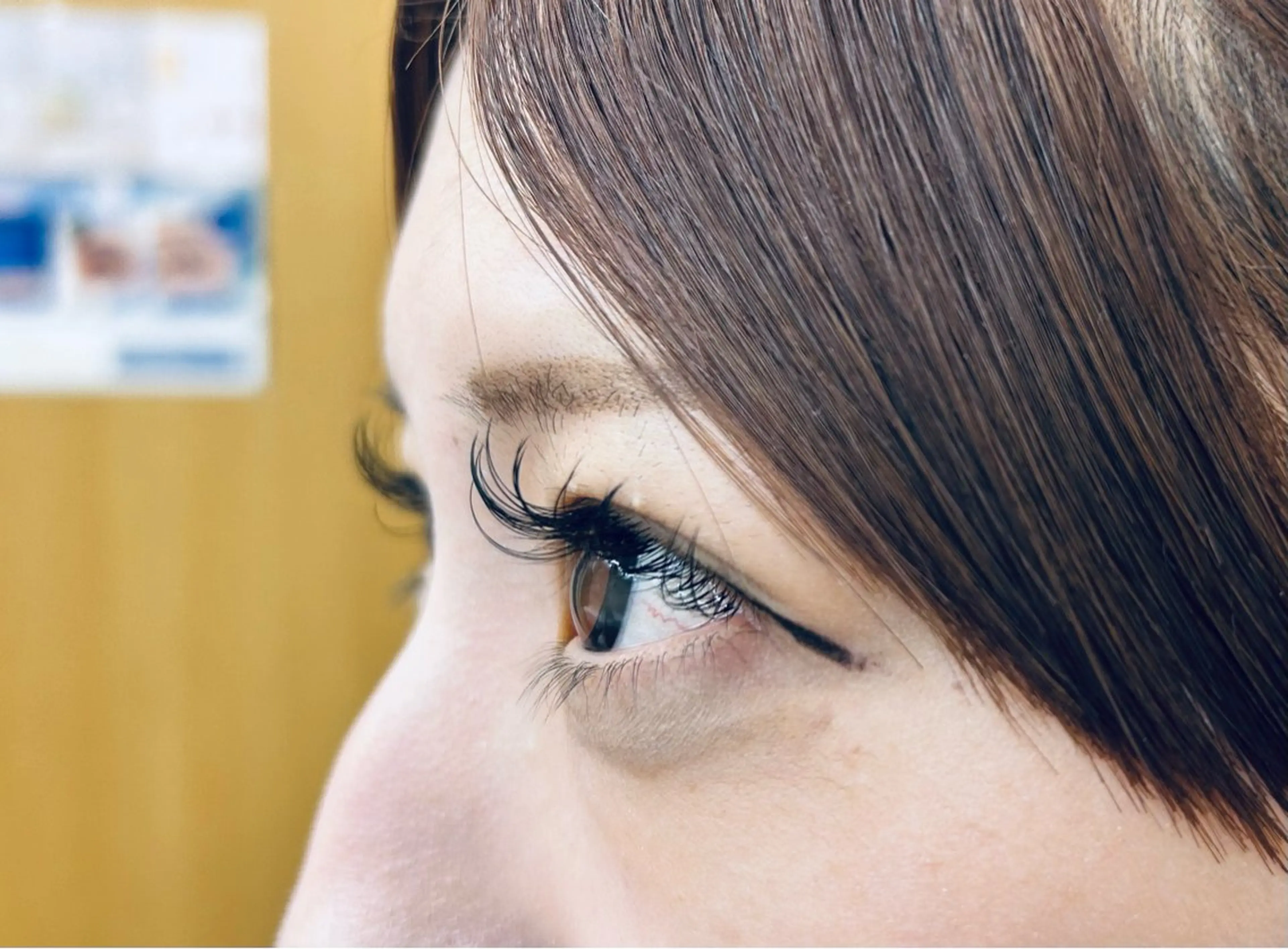 フラットラッシュ100本の写真