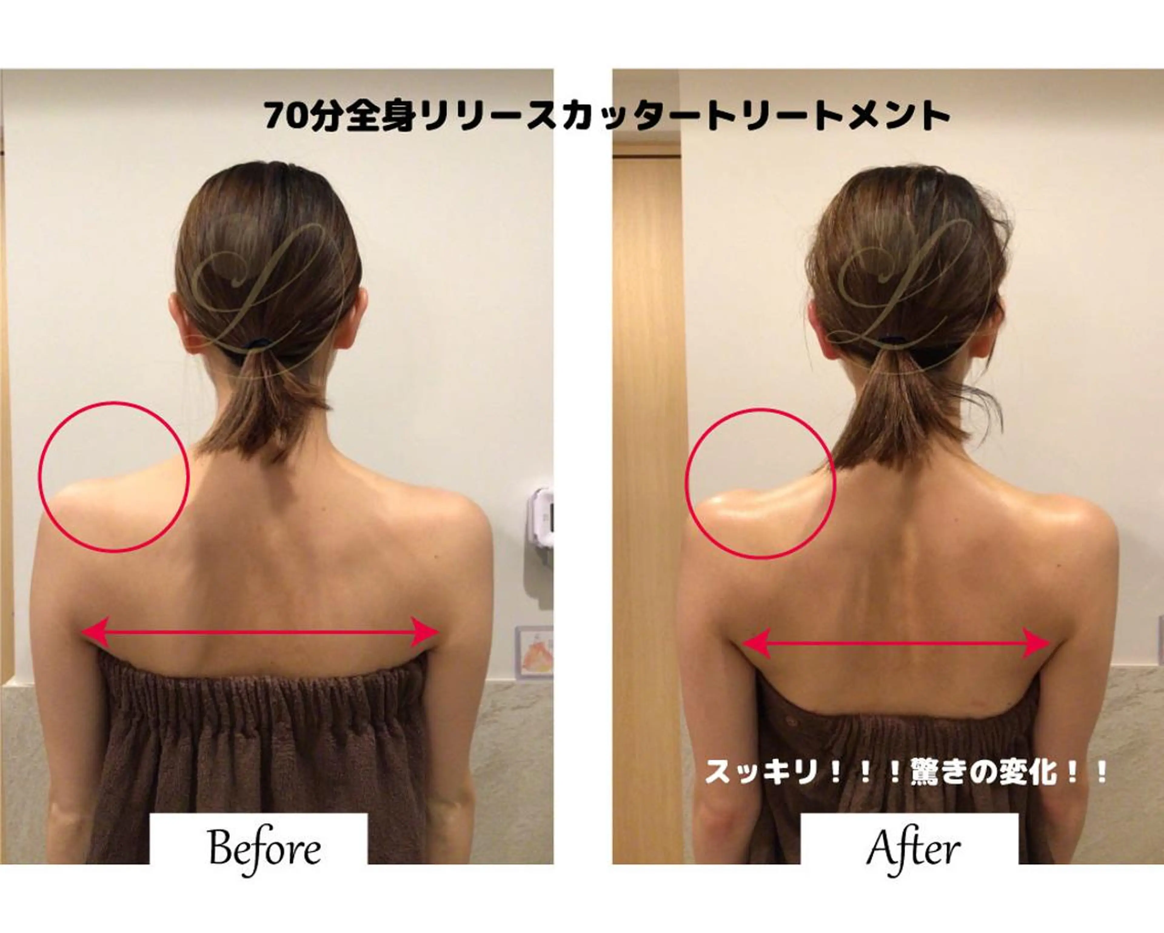 痩身×フェイシャル ブライダル|Linoのエステ・リラクイメージ