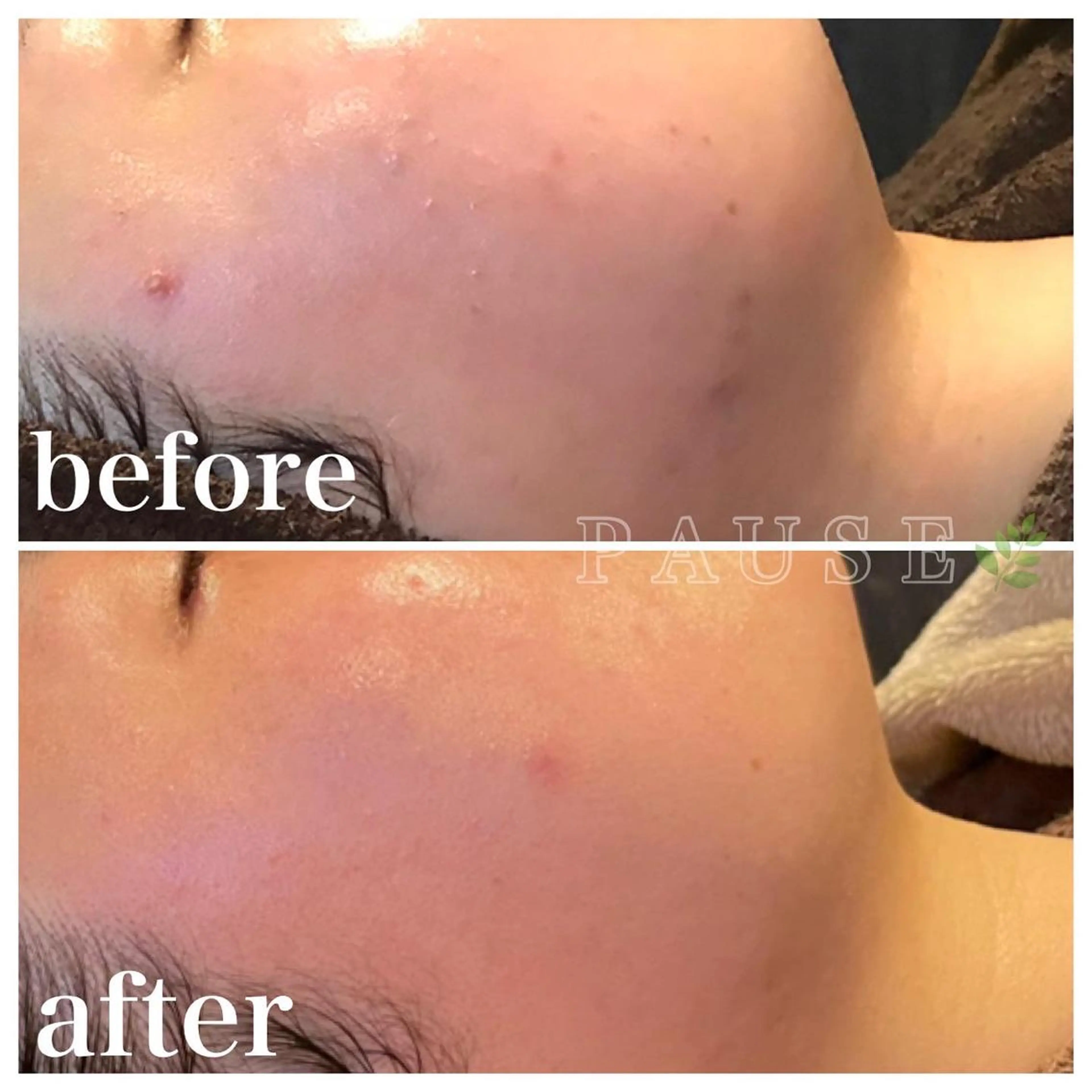 エステ 浜野 恵美のエステ・リラクイメージ