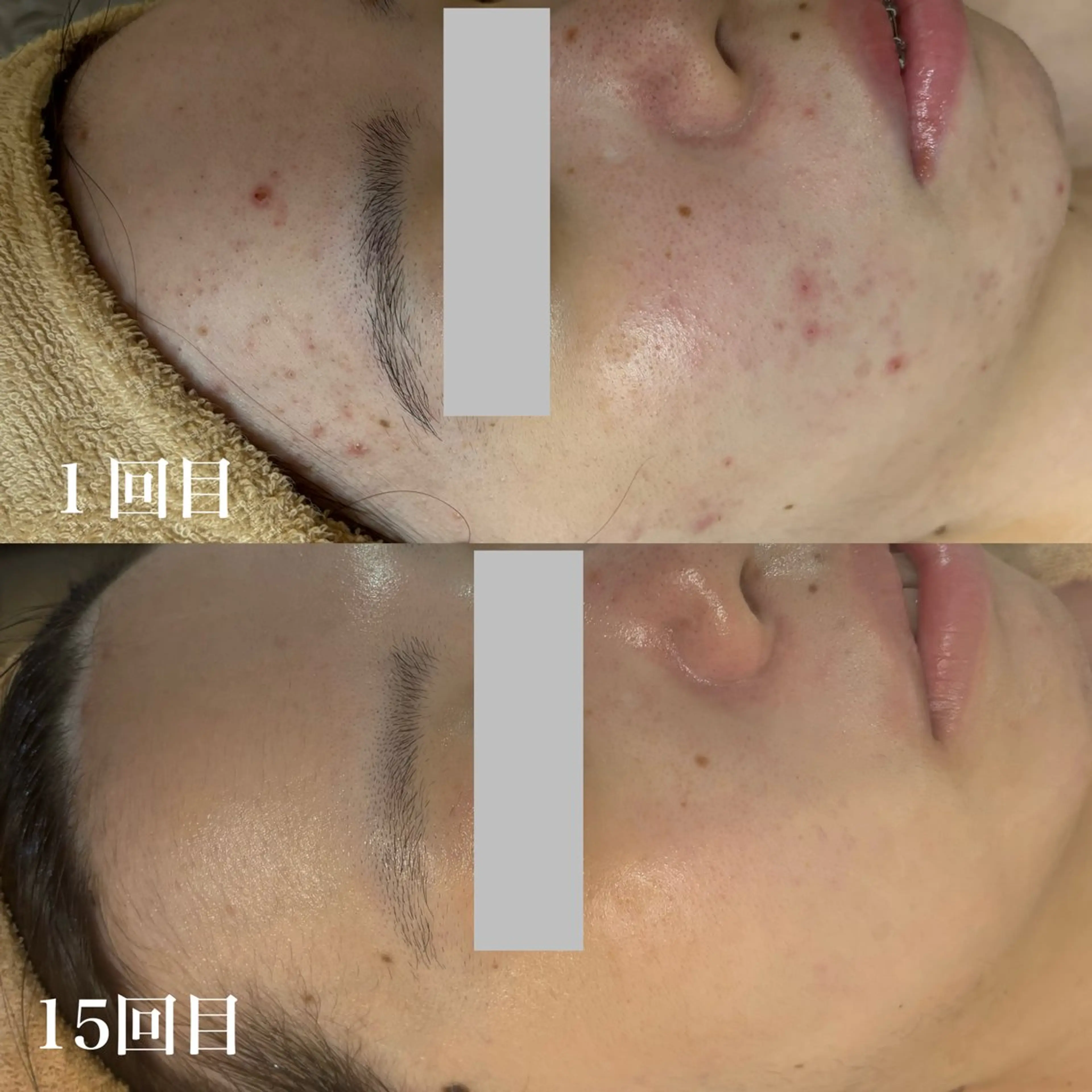 エステ WHITE AQUA 北千住店のエステ・リラクイメージ