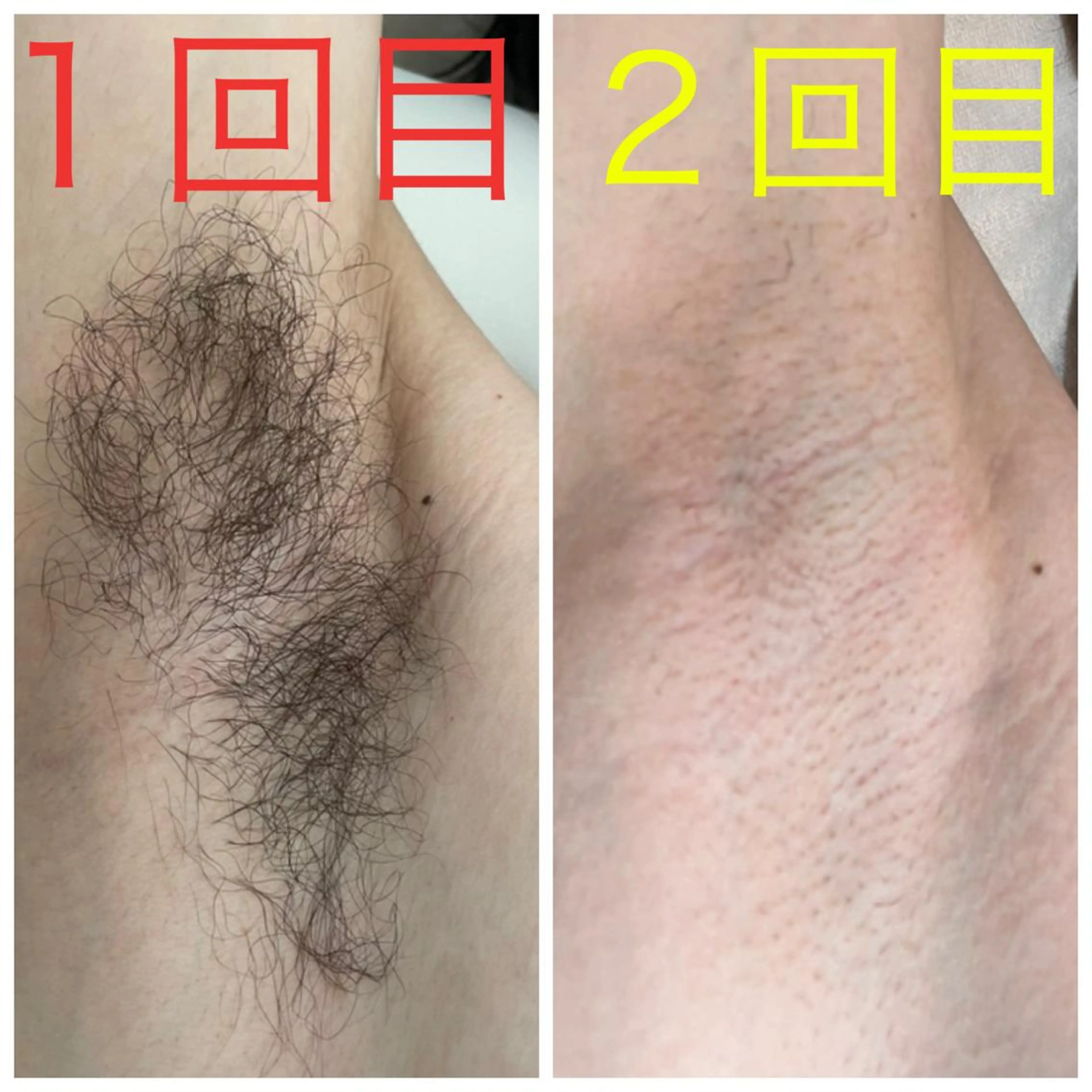 ﾄｰﾀﾙｽｷﾝｹｱ美容Room所属・トータルスキンケア 美容Roomのエステ・リラクイメージ