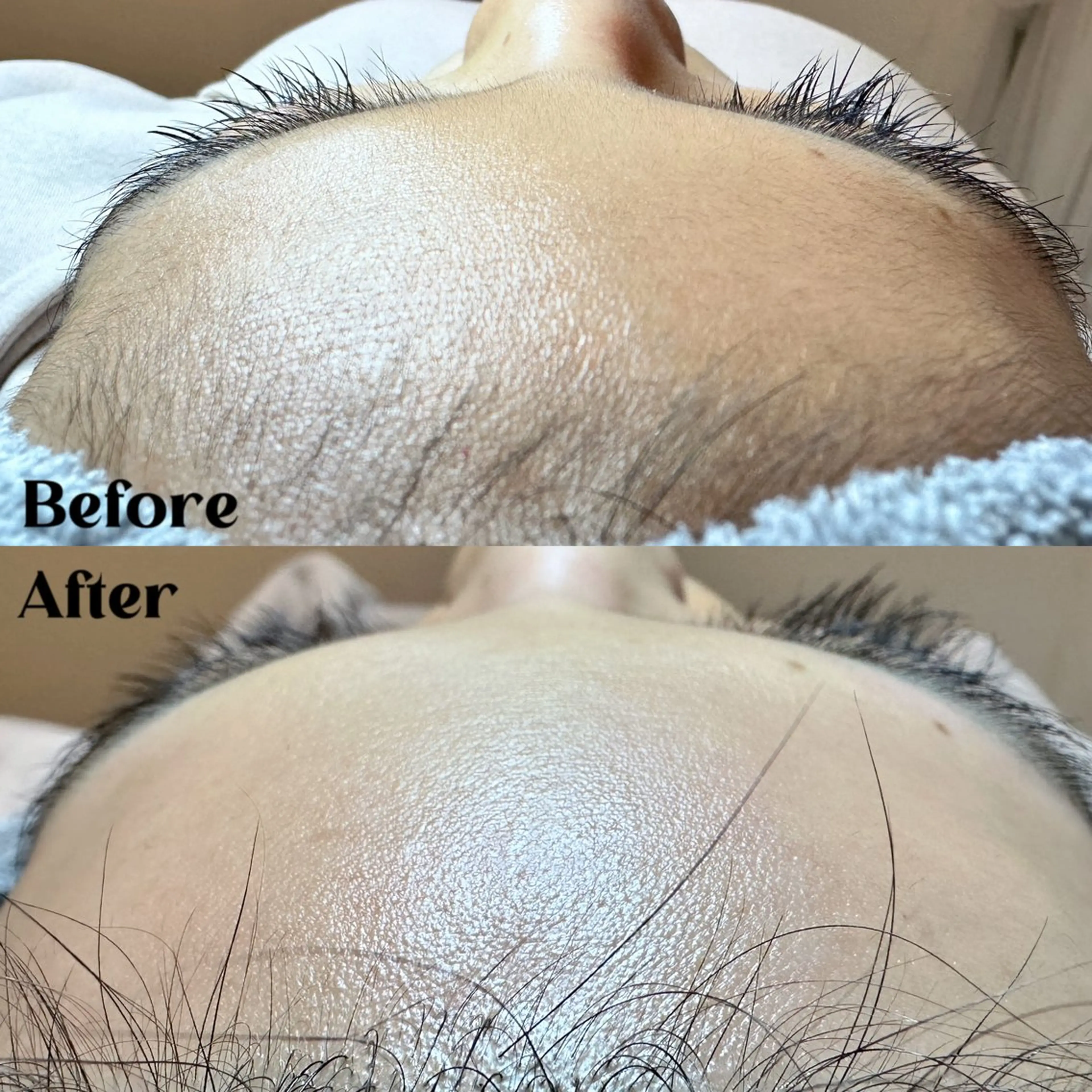 Hit. シュガーリング豊橋のエステ・リラクイメージ