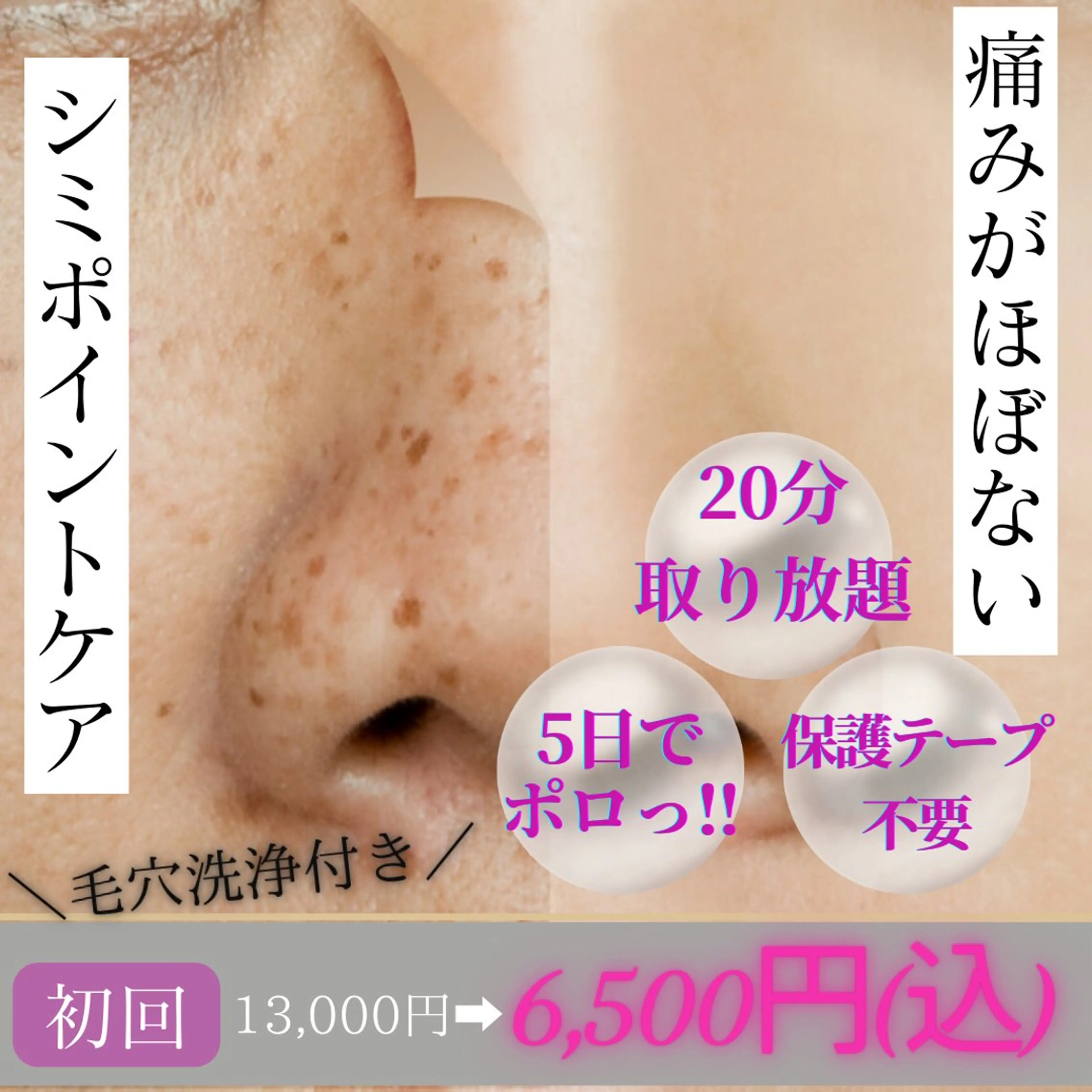 【初回/ポロっとシミ改善◎】シミケア/毛穴洗浄×20分取り放題(20~40個程)約50分の写真