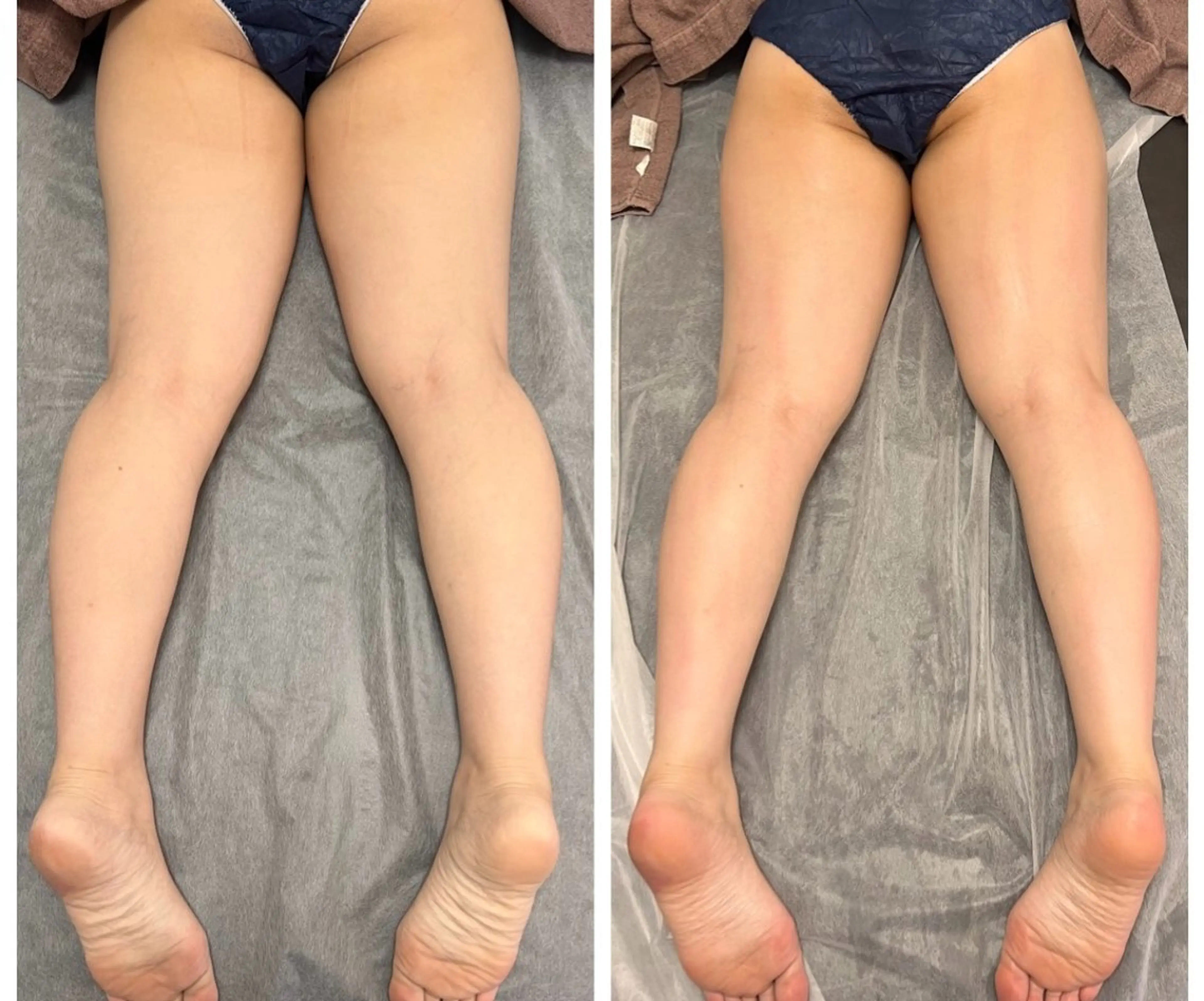 その他 本気で痩せたい方へ 痩身専門サロンのその他イメージ