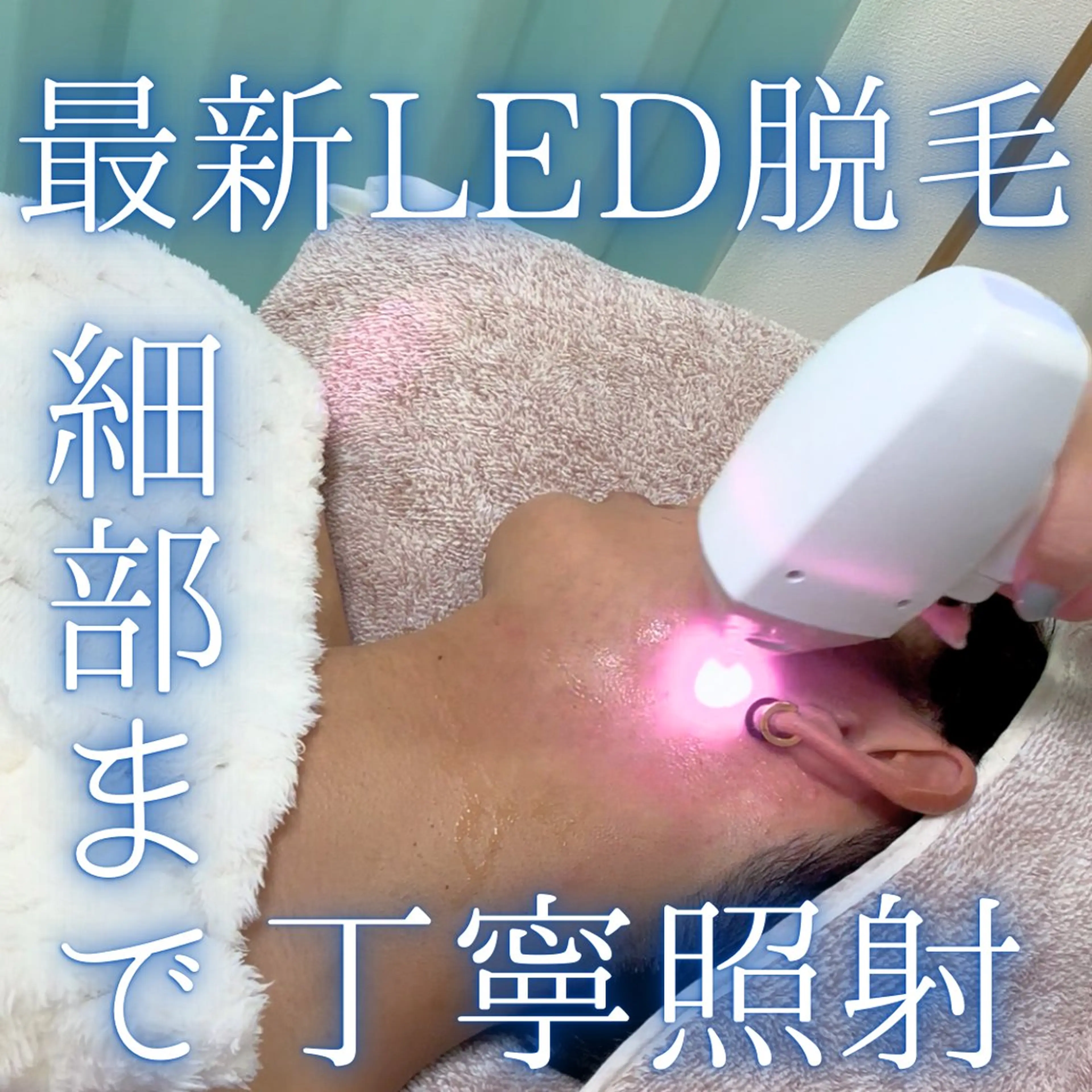 【男性限定】ヒゲ脱毛の写真