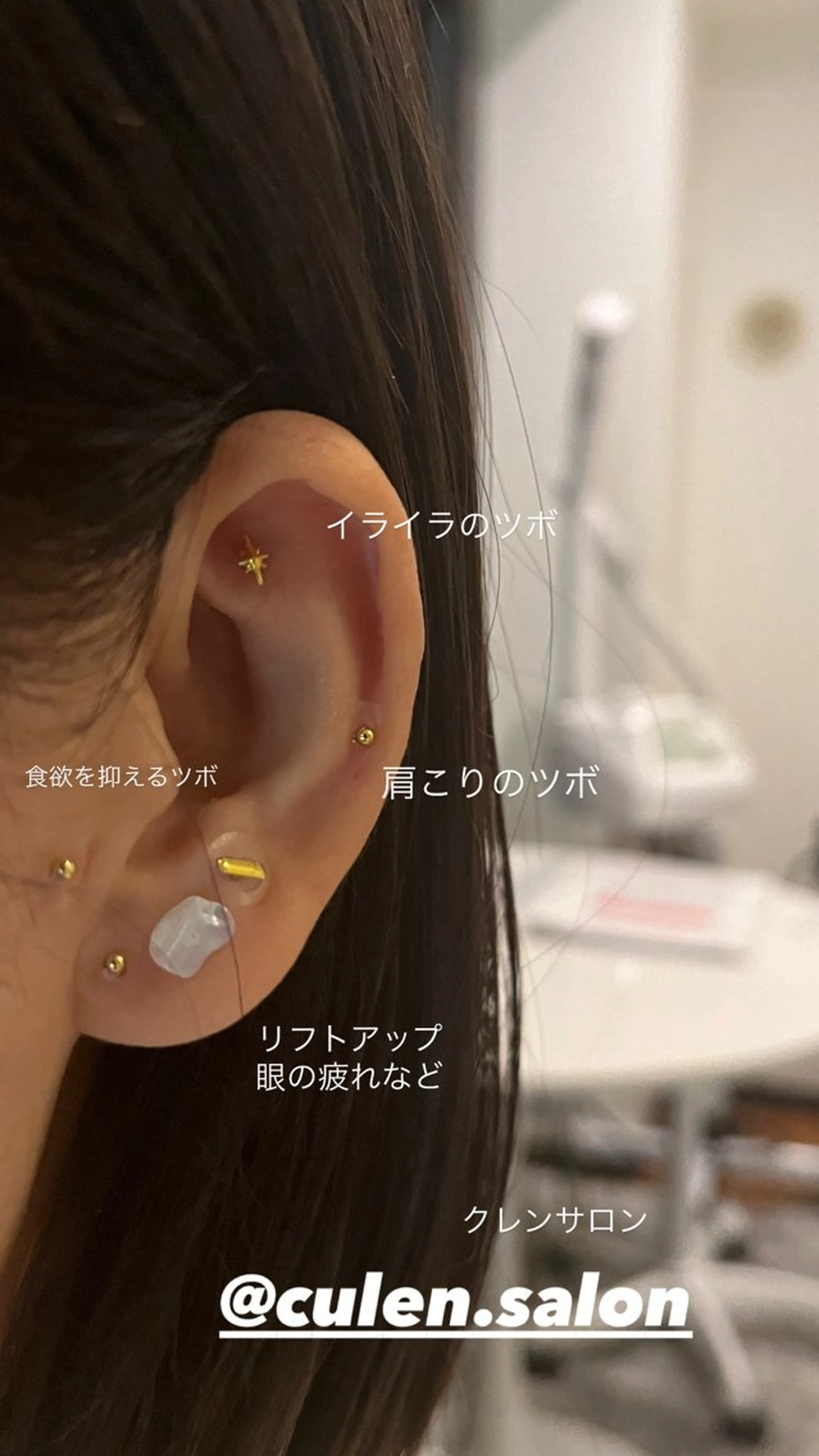 その他 【天神】毛穴・インデ ィバ・ボディケアのエステ・リラクイメージ