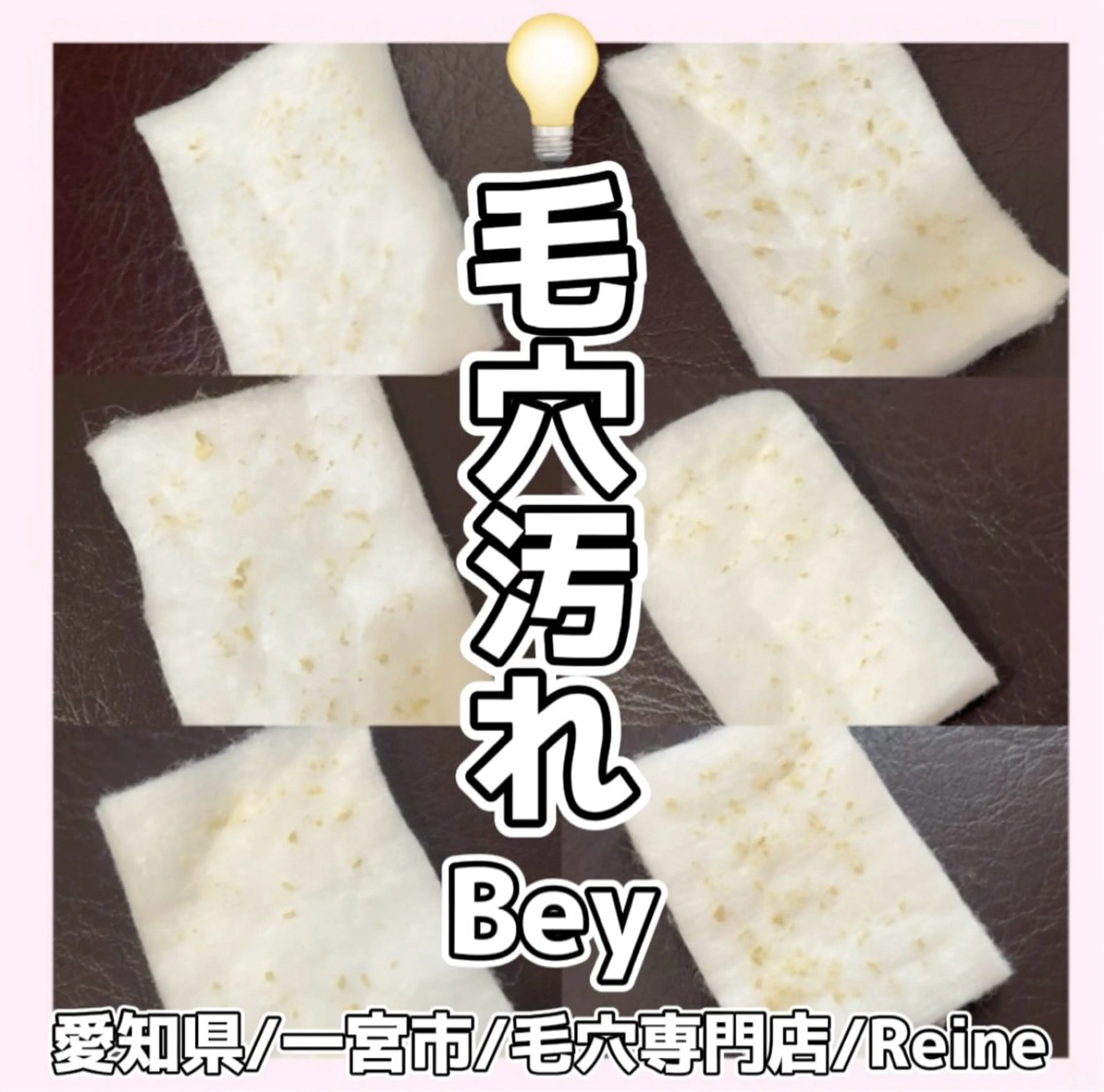 エステ Reine BeautySalon所属・毛穴/シミ肝斑/脱毛 横山梨里のエステ・リラクイメージ