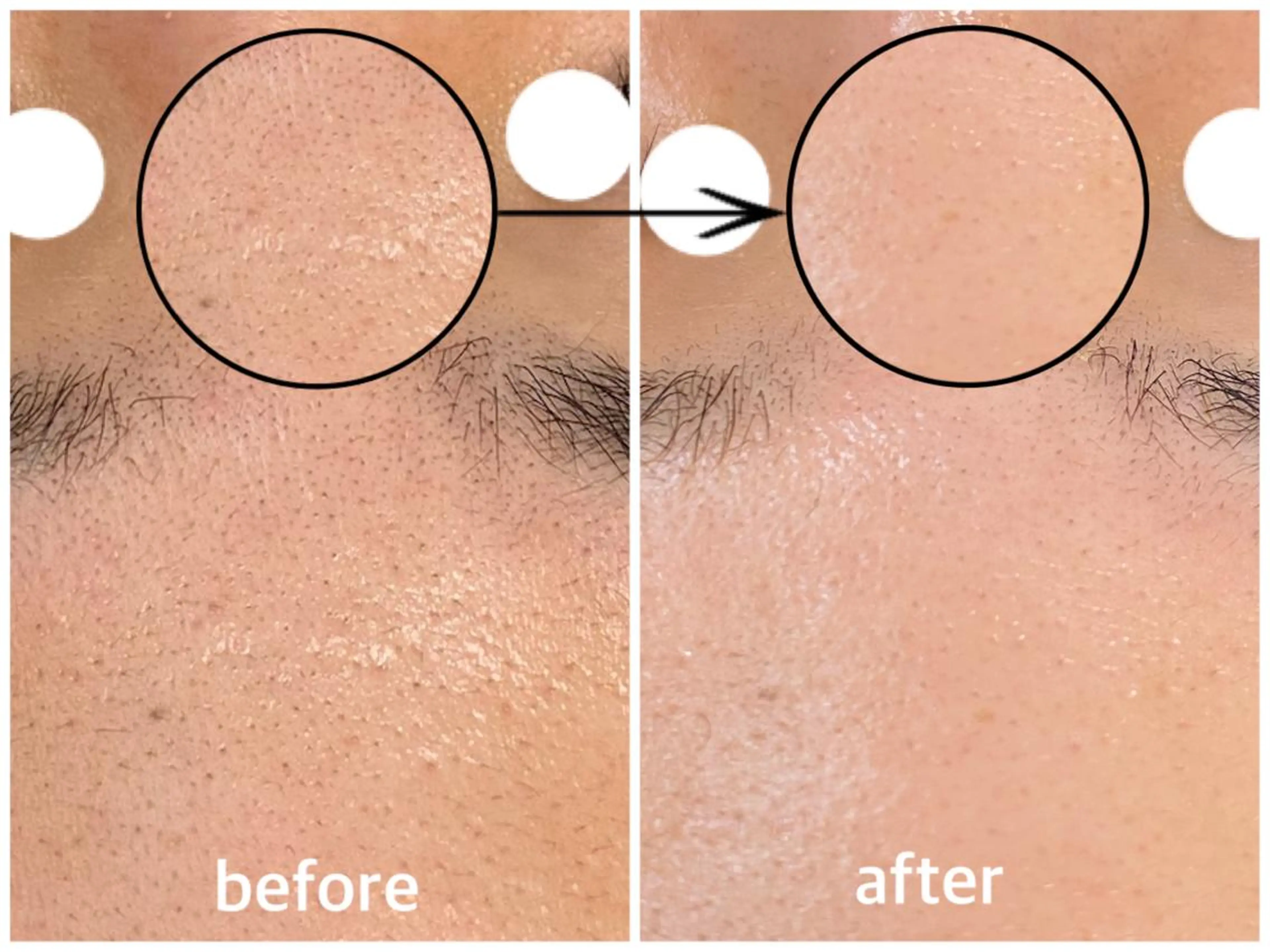 韓国肌管理 【毛穴専科】のエステ・リラクイメージ