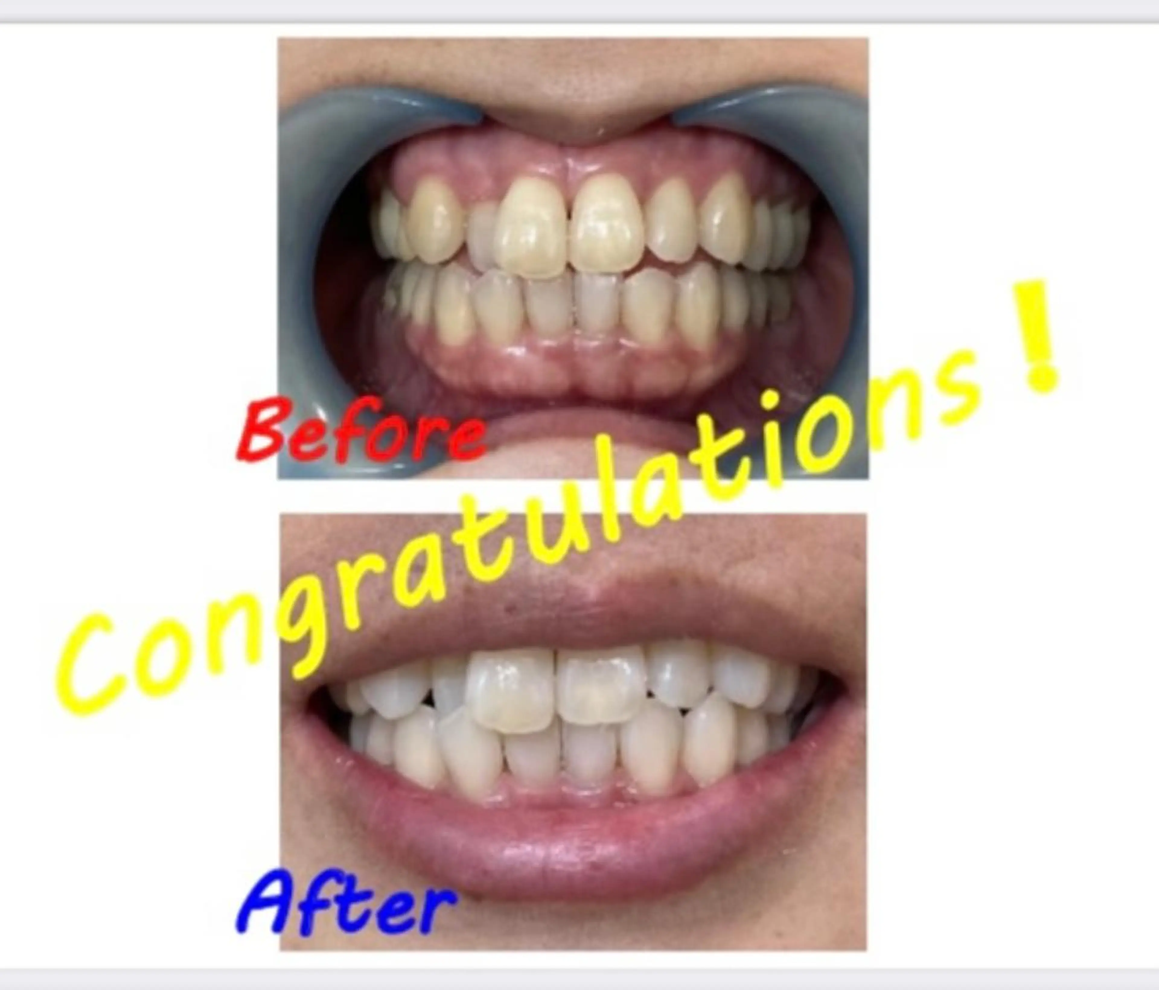 その他 セルフホワイトニングサロン　ラヴィアン所属・ホワイトニングサロン La vie enのその他イメージ