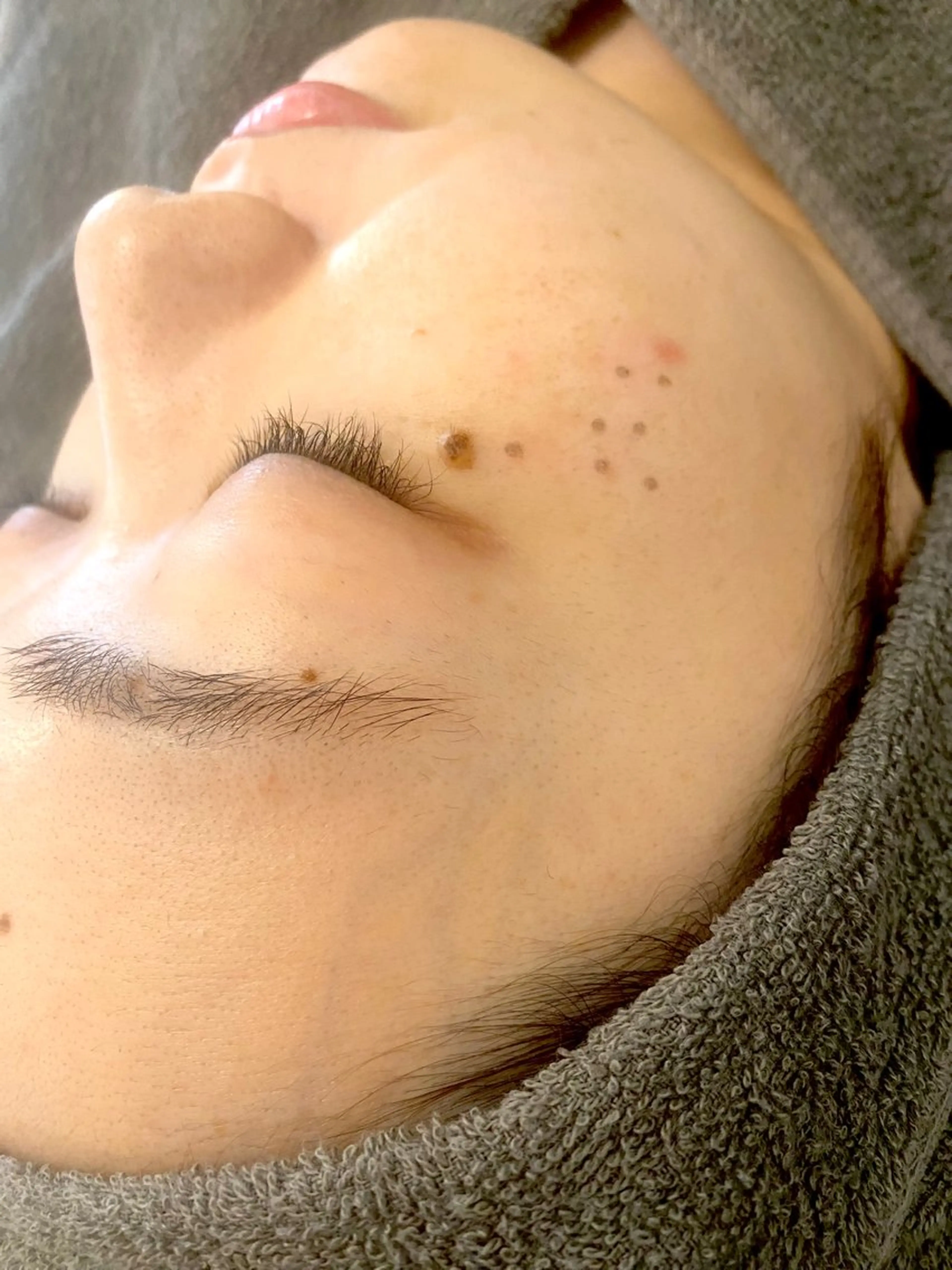 【時間がないけどケアはしたい】手早くクイックシミケアコース🪄の写真