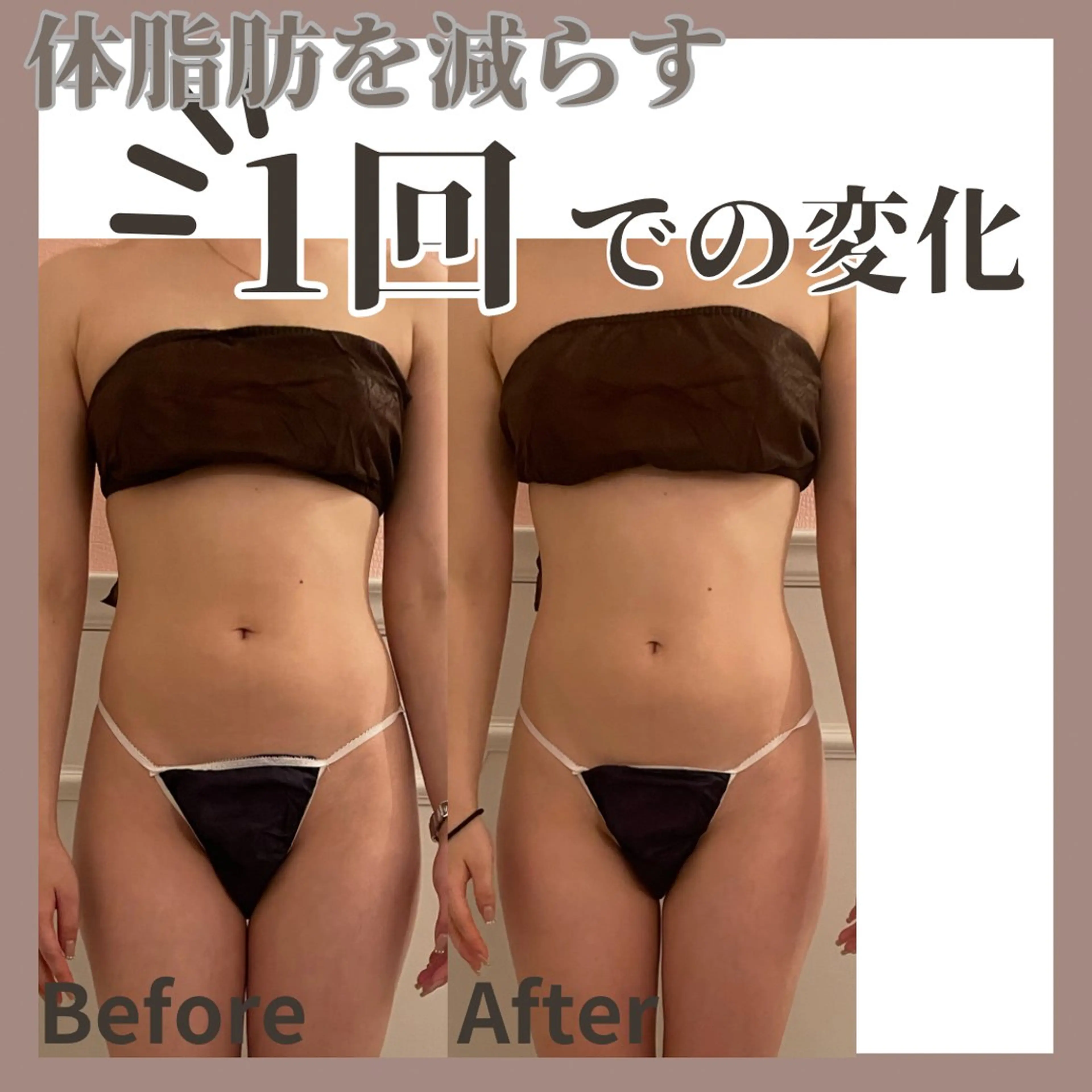 【 脂肪撃退/むくみ解消 】本格上半身痩身コース🔥※背中・二の腕・お腹の写真