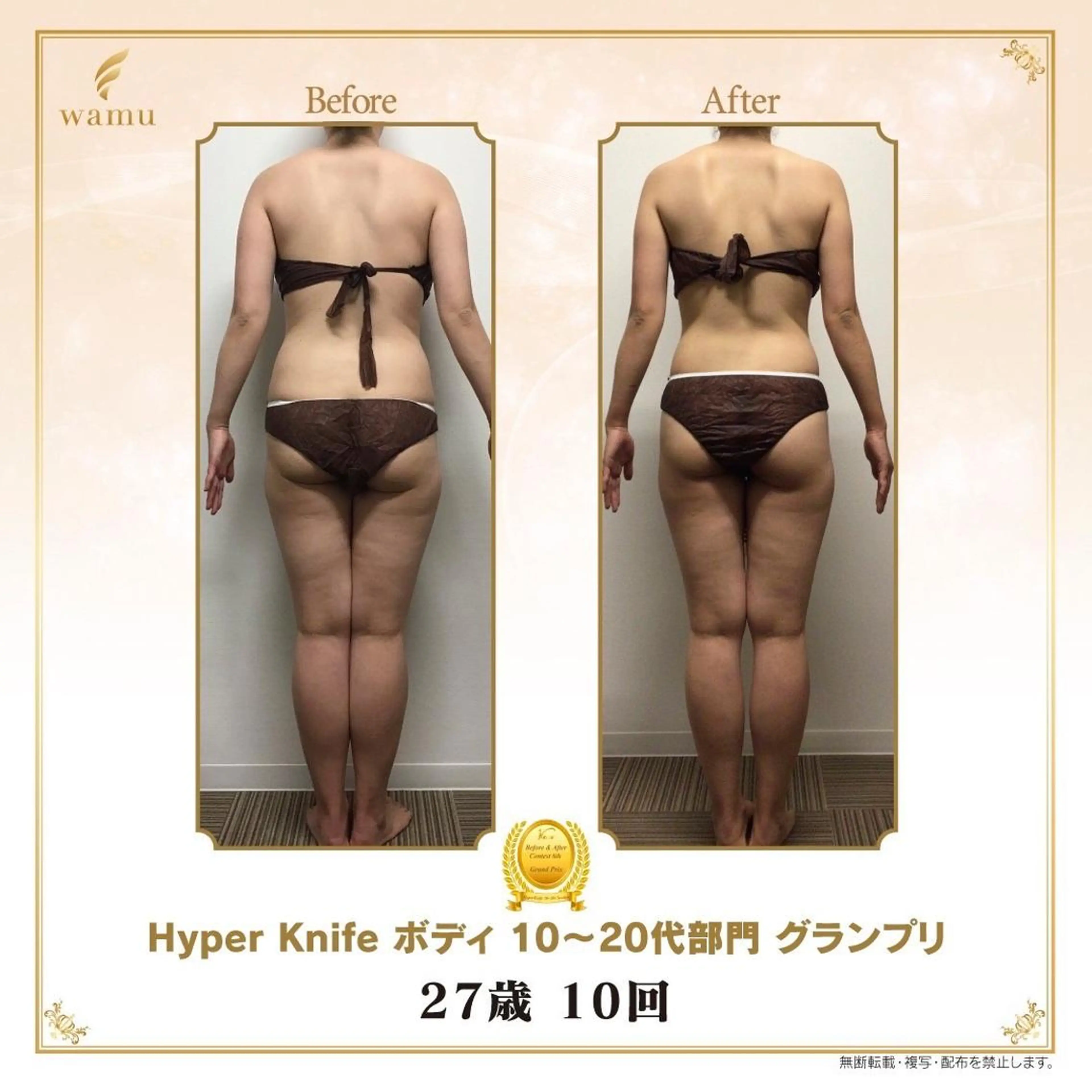 アロマクイーン所属・所沢痩身小顔コルギ AromaQueenのエステ・リラクイメージ