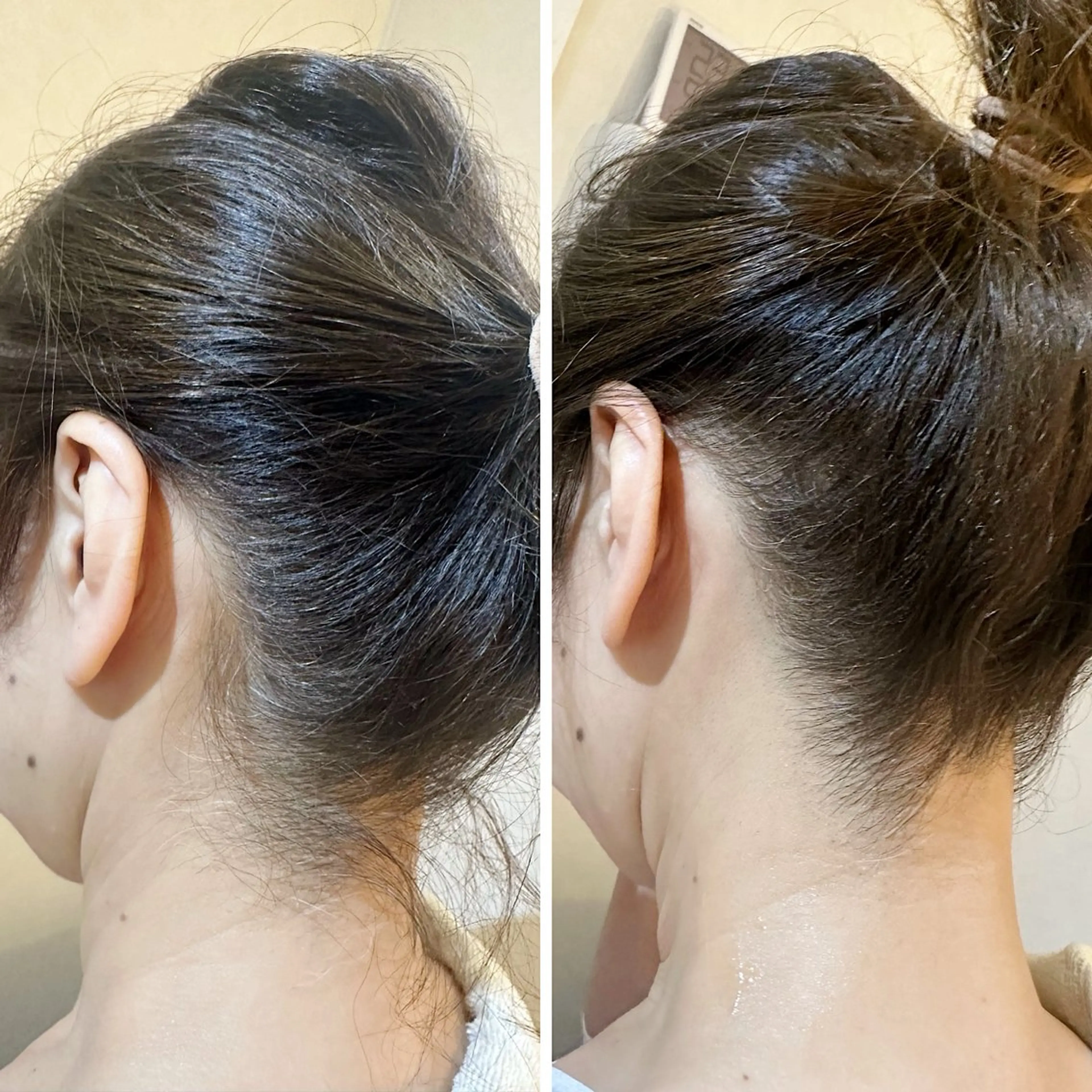 脱毛 うなじ脱毛/美肌脱毛 LABELのエステ・リラクイメージ