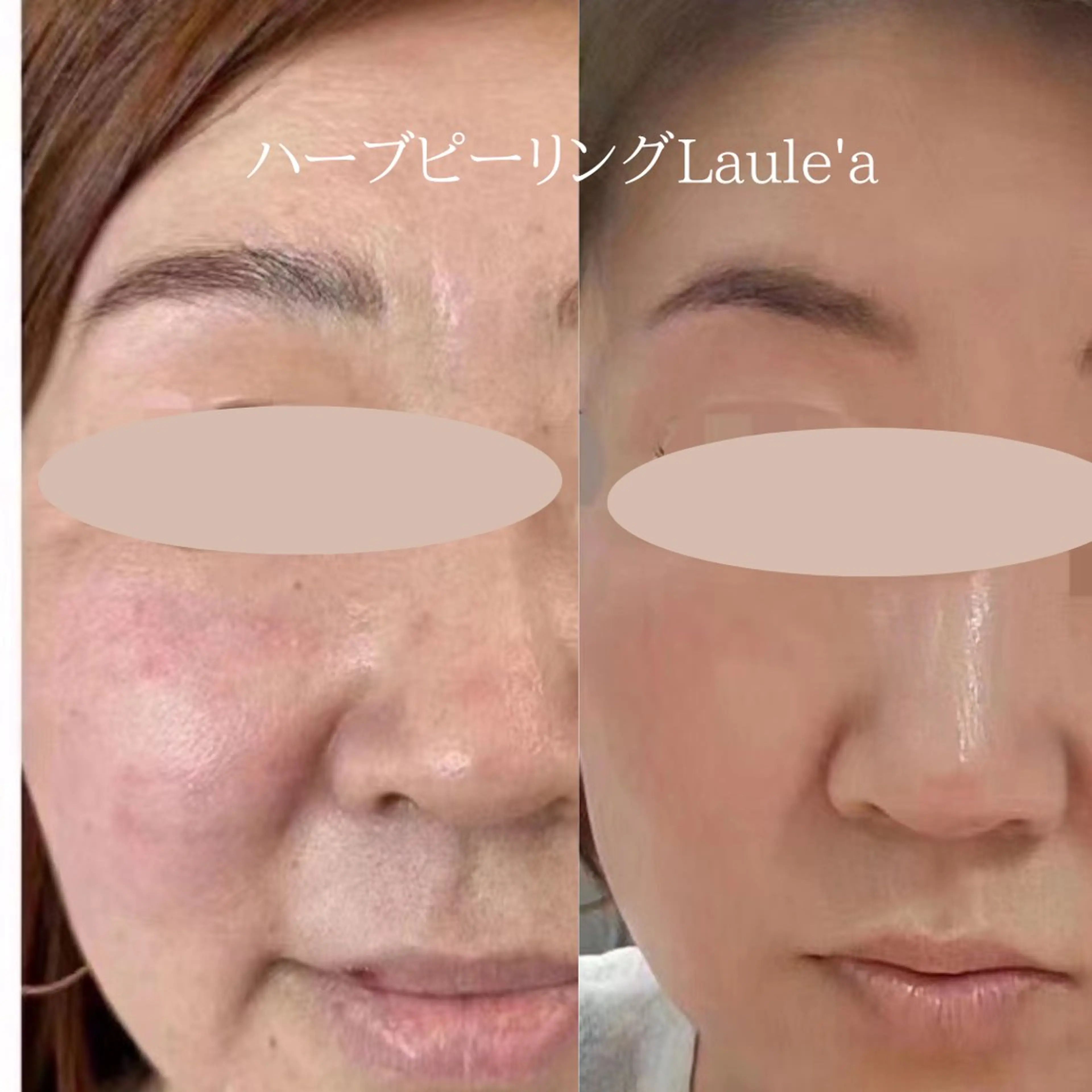 痩身/腸もみ/ ヘッドスパ/リンパのエステ・リラクイメージ