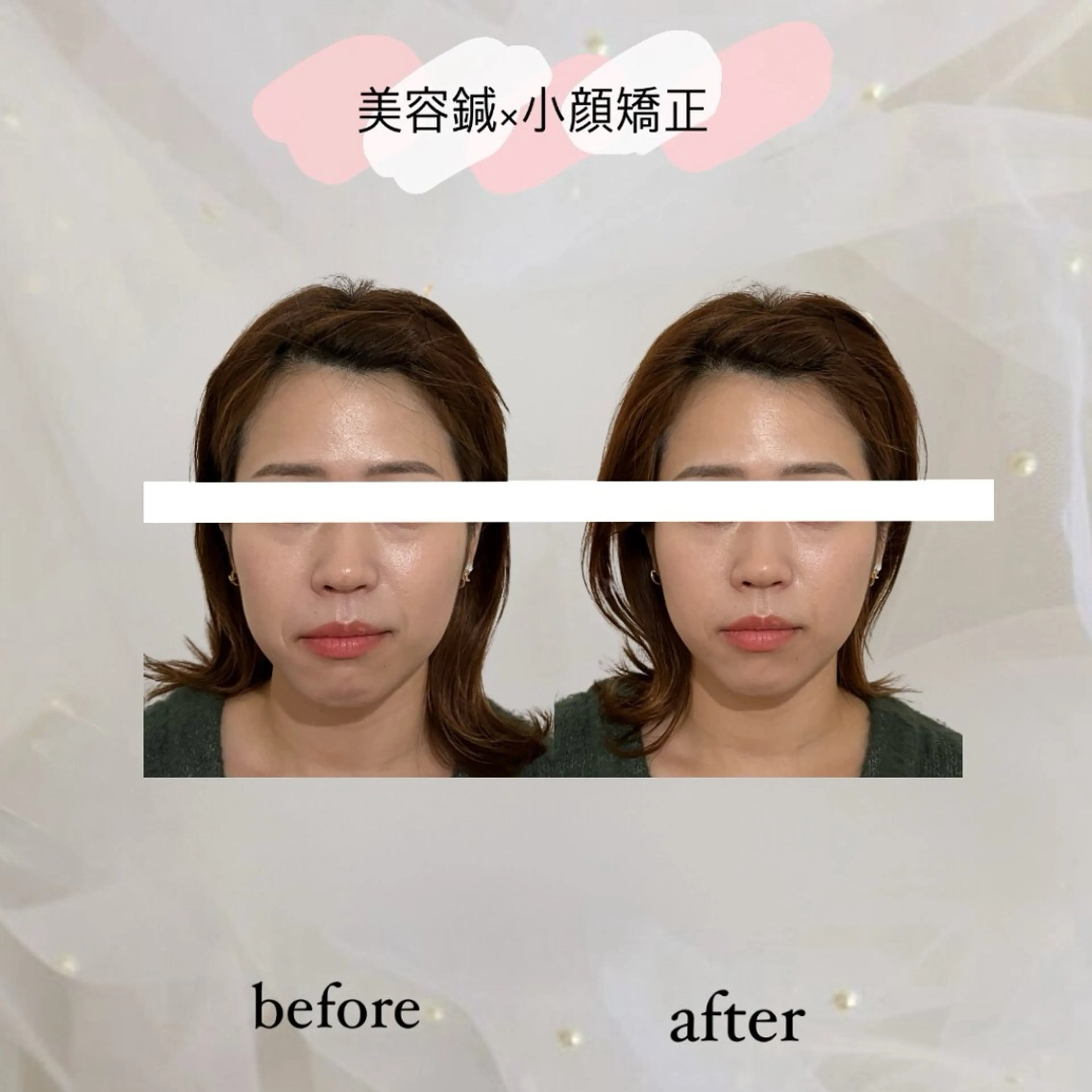 エステ リラク harisalon aleumのエステ・リラクイメージ
