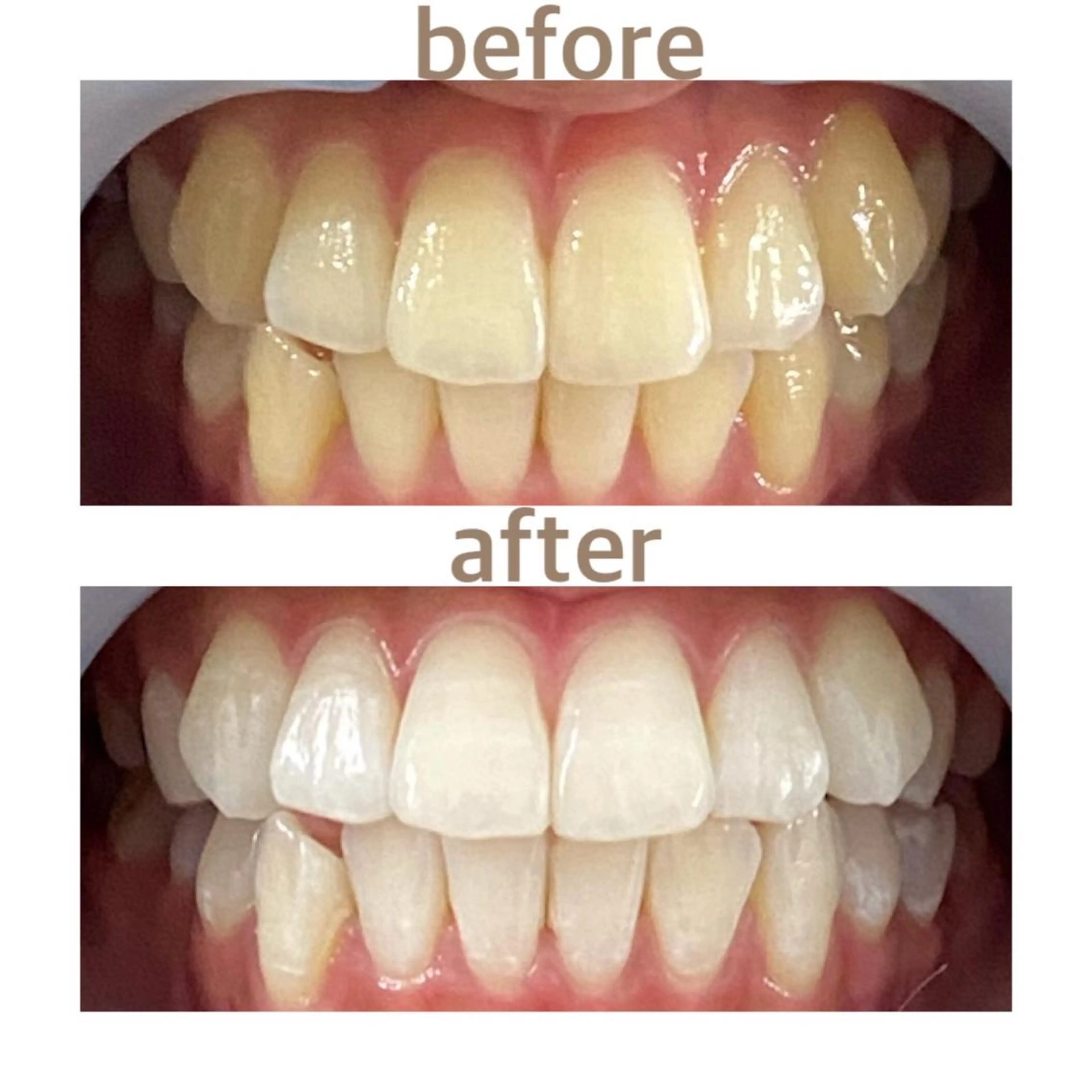 メンズ エステ リラク ホワイトニング ショップ本八幡店のエステ・リラクイメージ