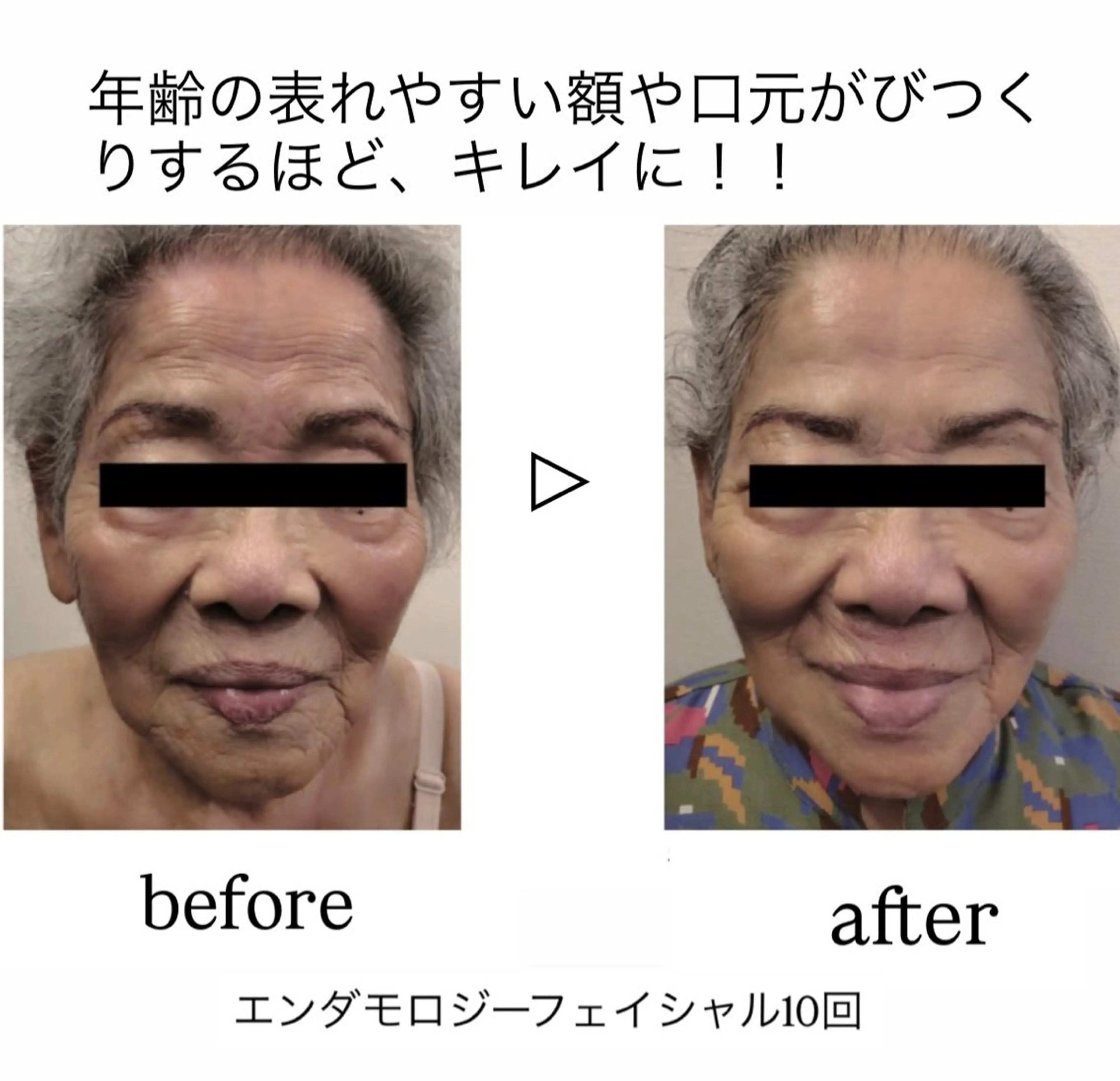 エステ Binosu所属・エンダモロジー BINOSUのエステ・リラクイメージ