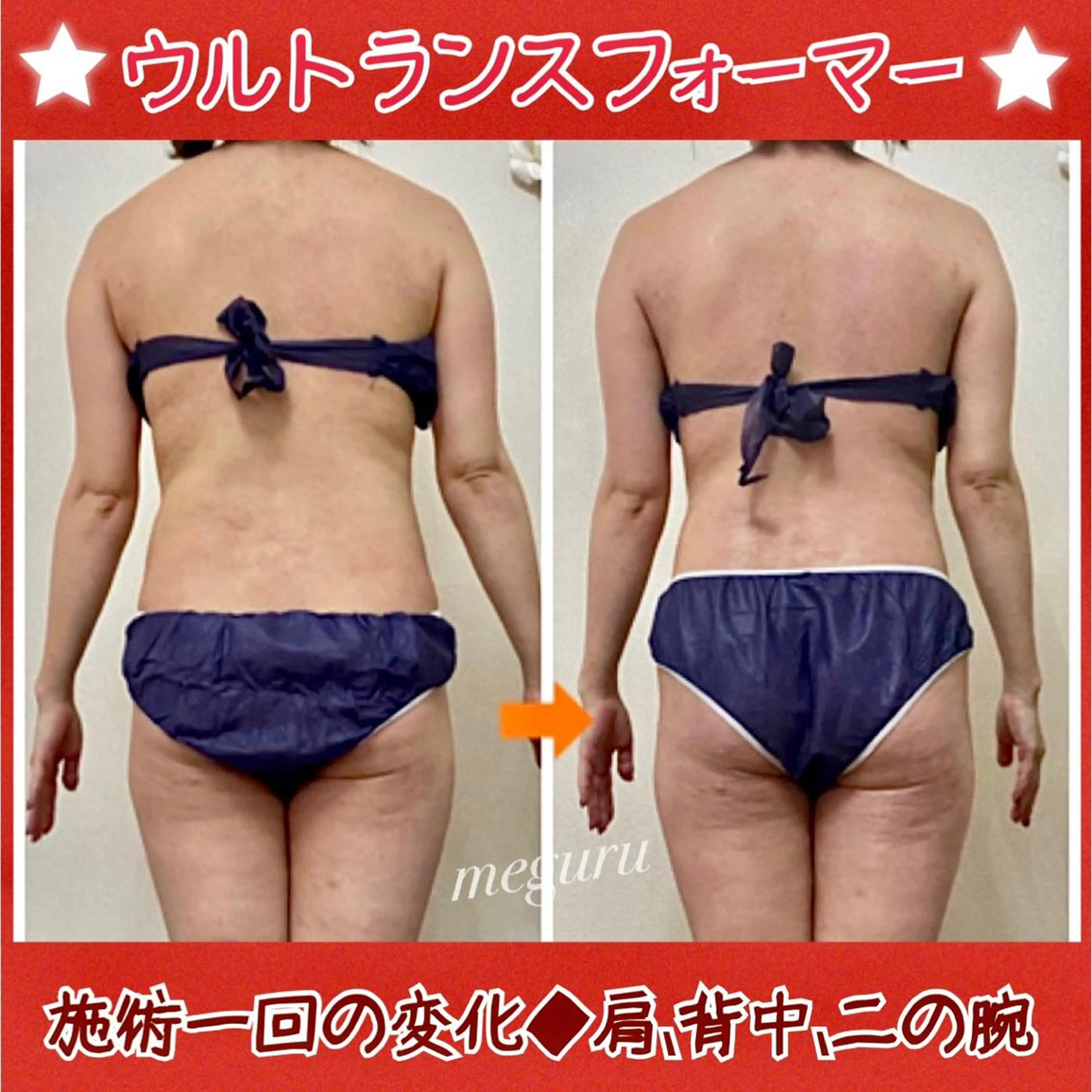 ショート カラー パーマ ヘアアレンジ メンズ キッズ ネイル マツエク・マツパ エステ リラク ‍痩身＆ボディ 結果出し🌟丹野のエステ・リラクイメージ