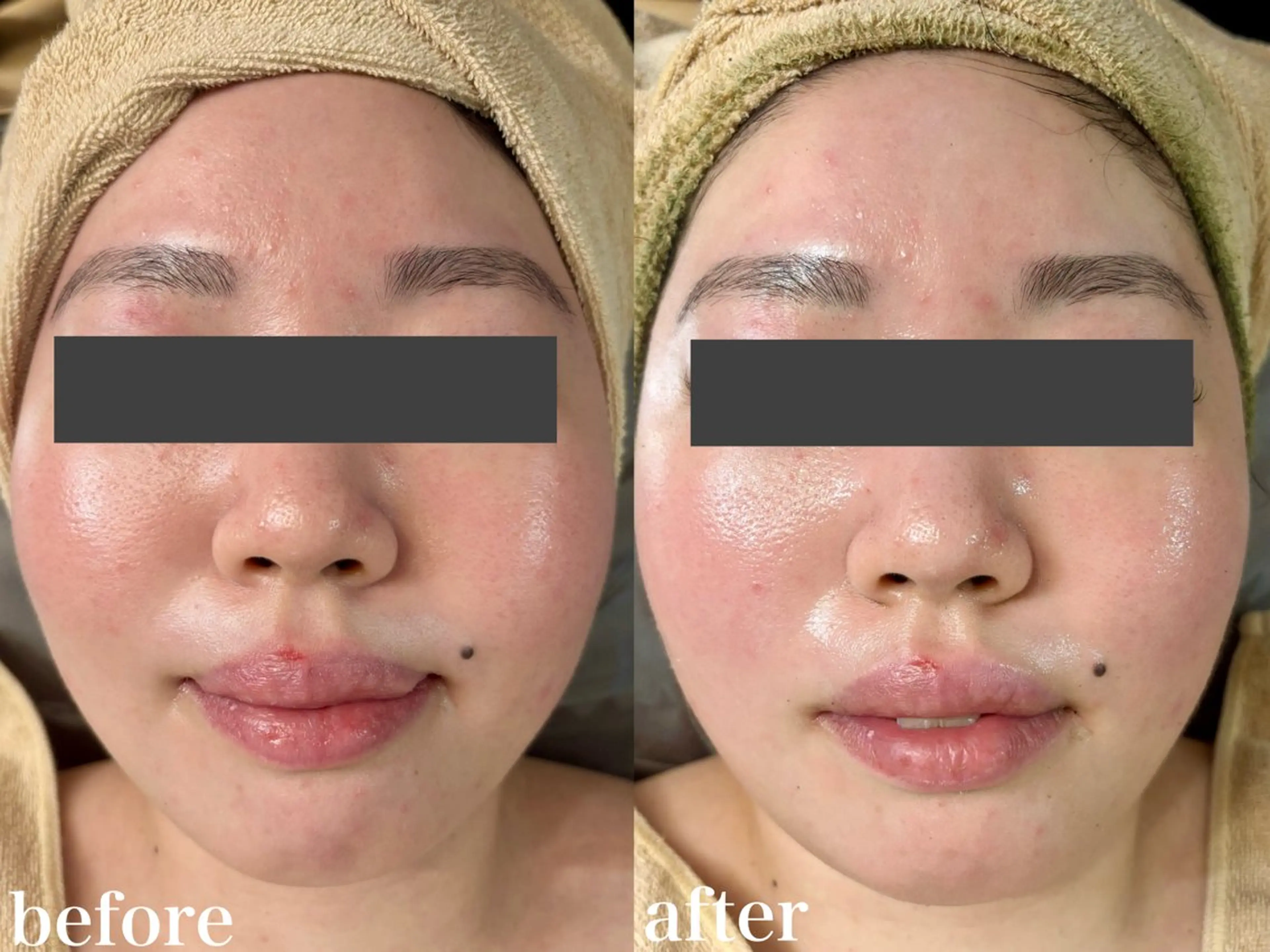 WHITE AQUA 北千住店のエステ・リラクイメージ