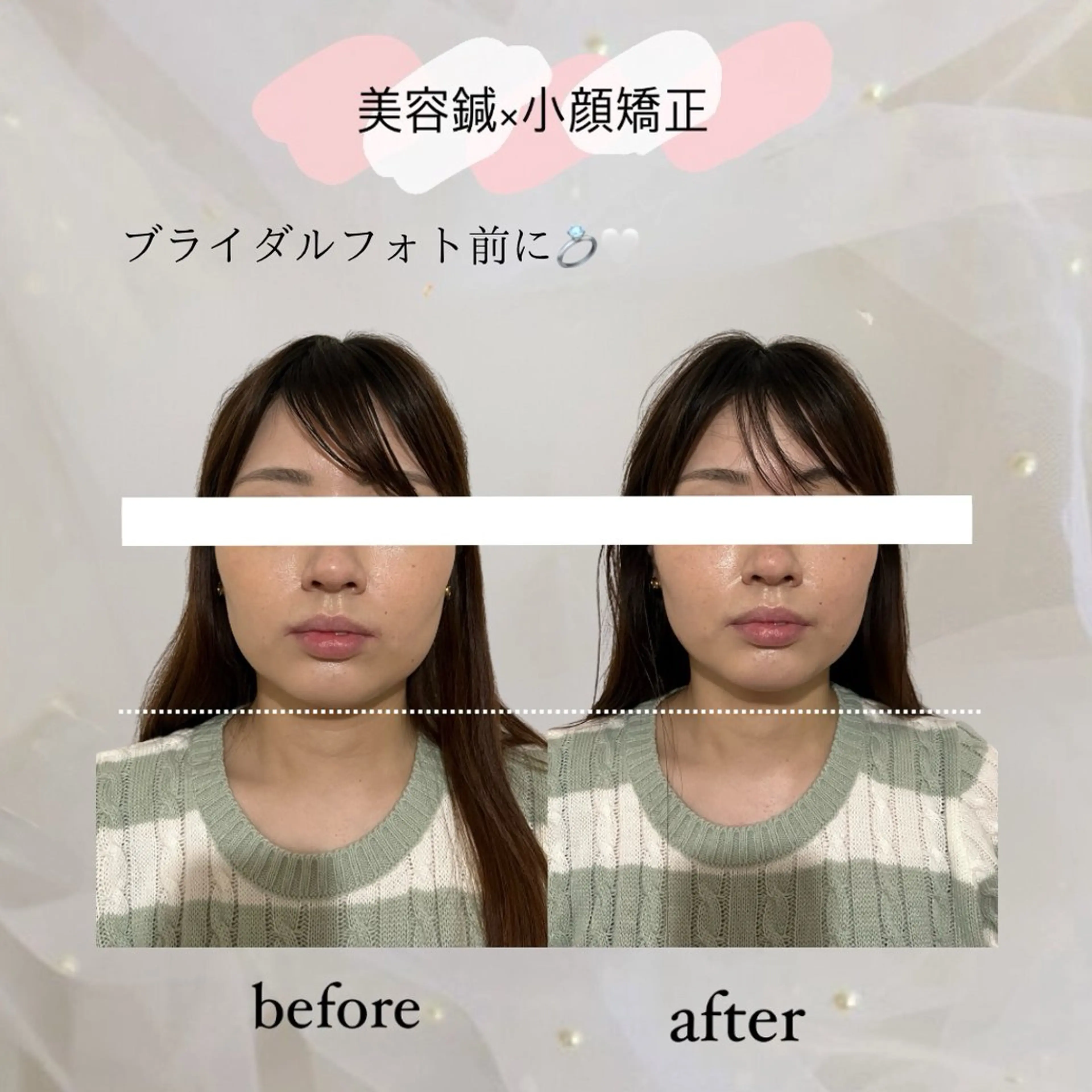 エステ リラク harisalon aleumのエステ・リラクイメージ