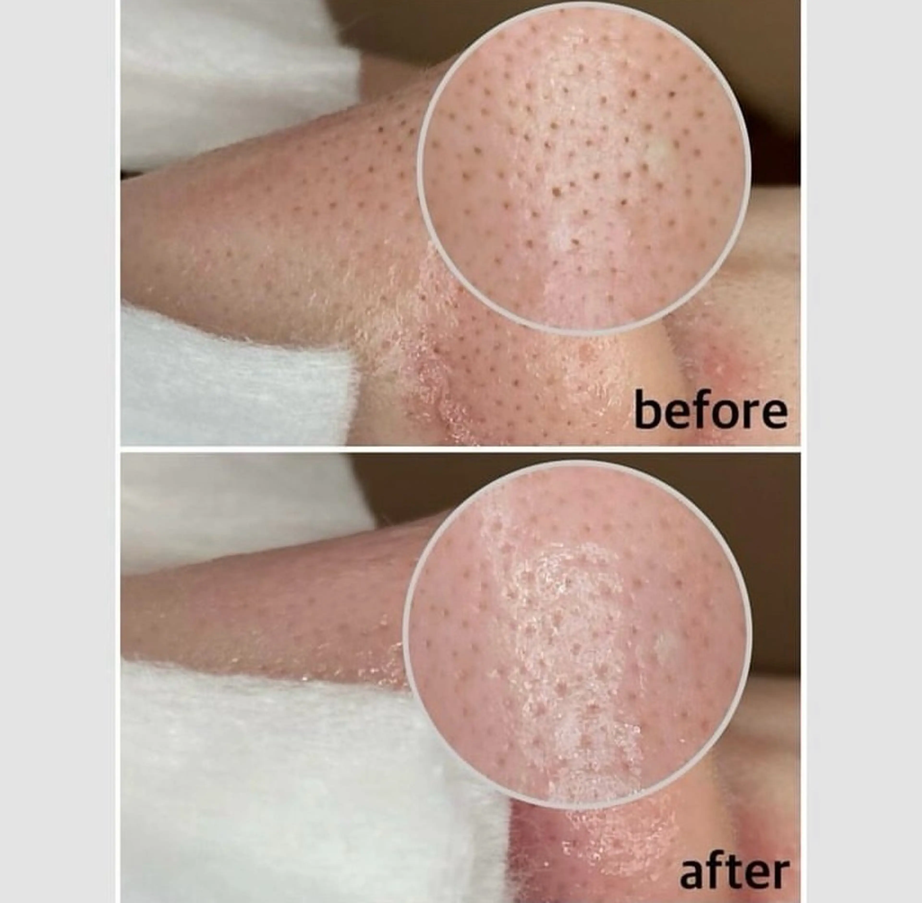 エステ リラク 韓国肌管理 【毛穴専科】のエステ・リラクイメージ