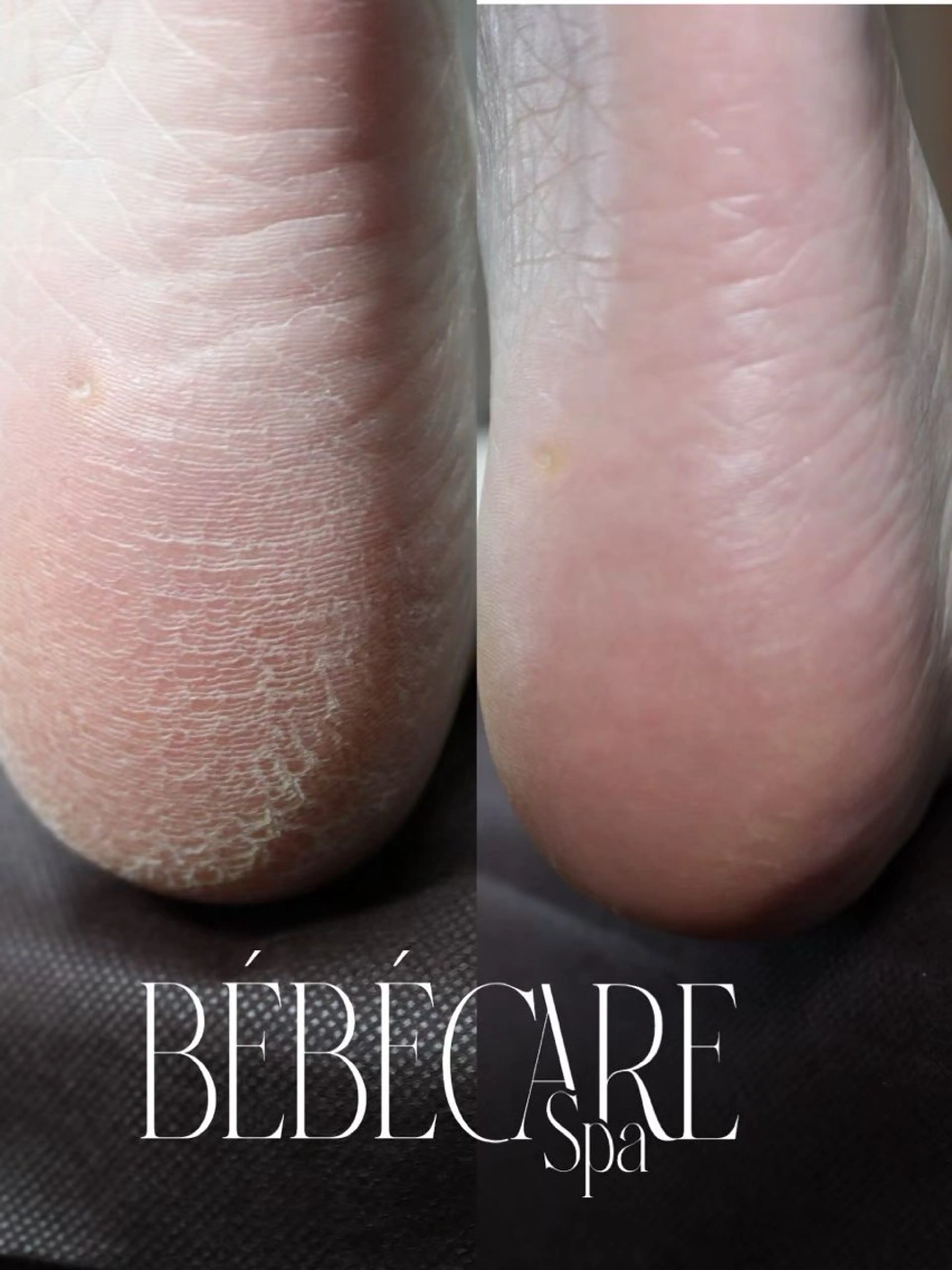 ネイル その他(ネイル) Nail salon REIRISのネイルデザイン