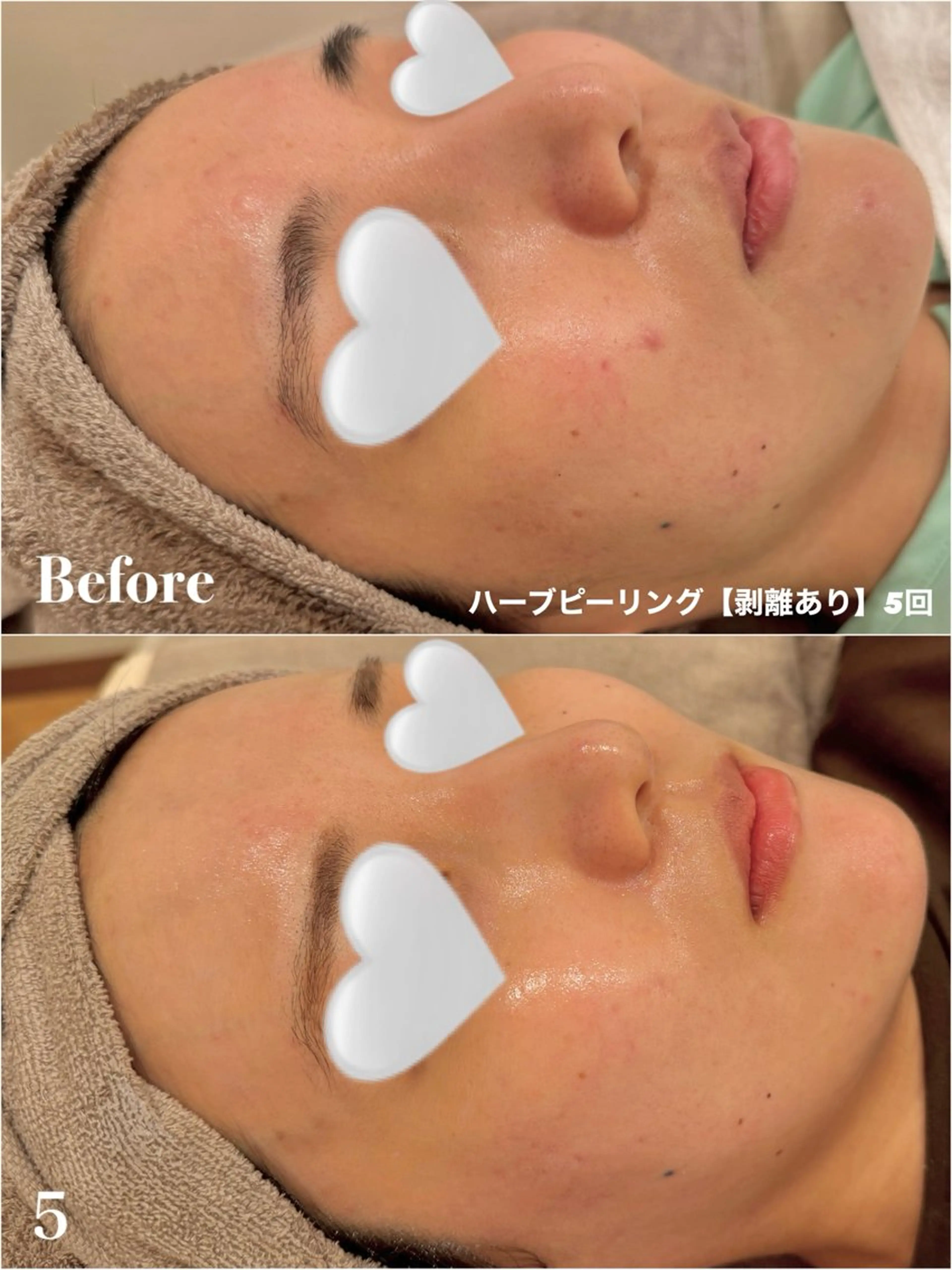 エステ Ayaka🤍 恵比寿/美容鍼/整体のエステ・リラクイメージ