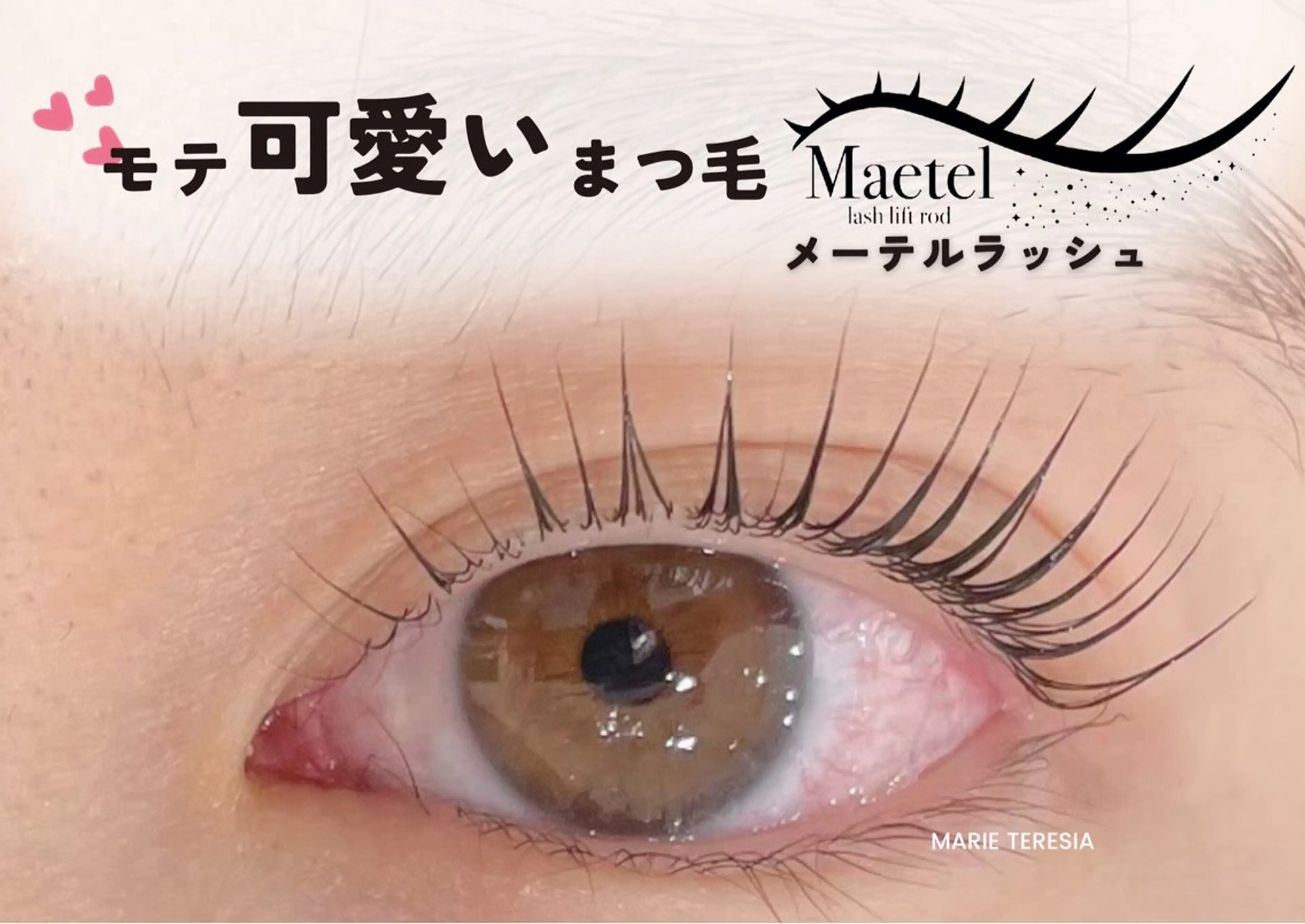 メーテルラッシュの写真