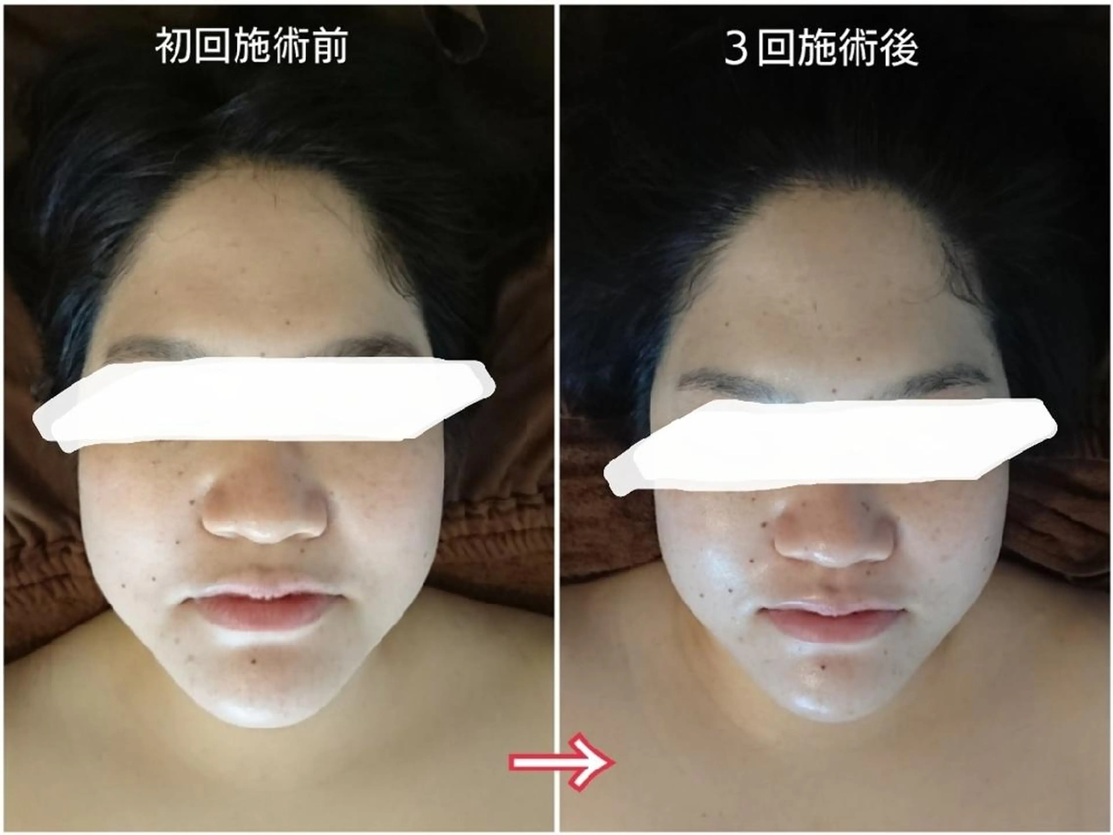 Jeliss~美爪育成ネイル＆頭蓋骨小顔矯正サロン~所属・美顔(小顔)矯正& 美爪育成Jelissのエステ・リラクイメージ